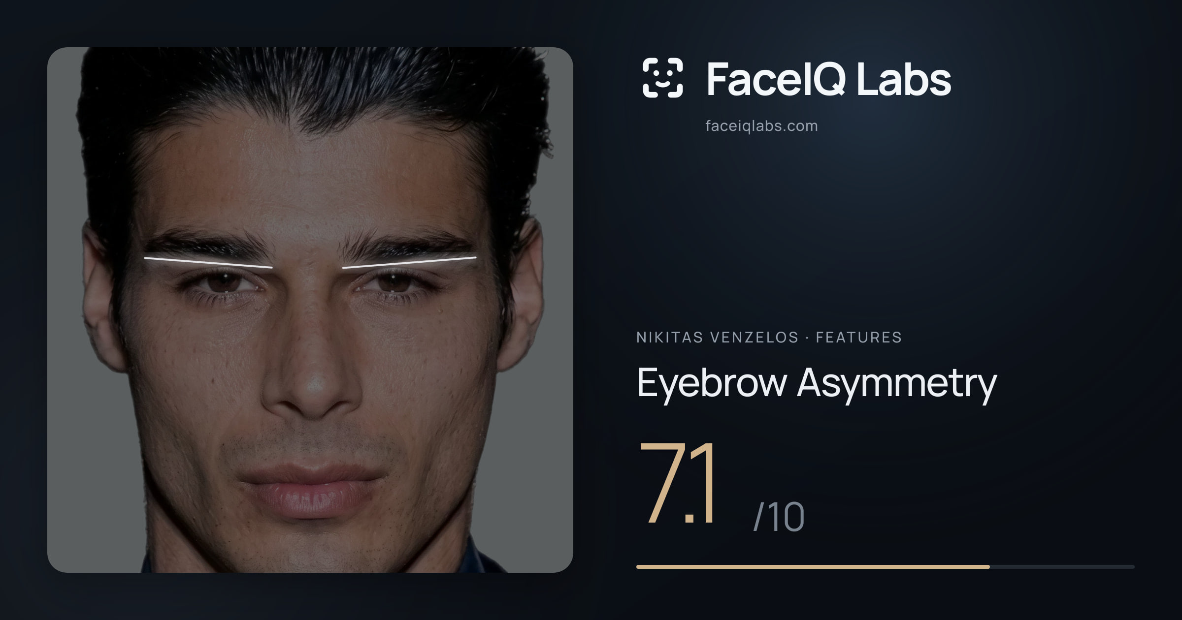 Nikitas Venzelos Eyebrow Asymmetry: 7.1/10, drawn on the photo