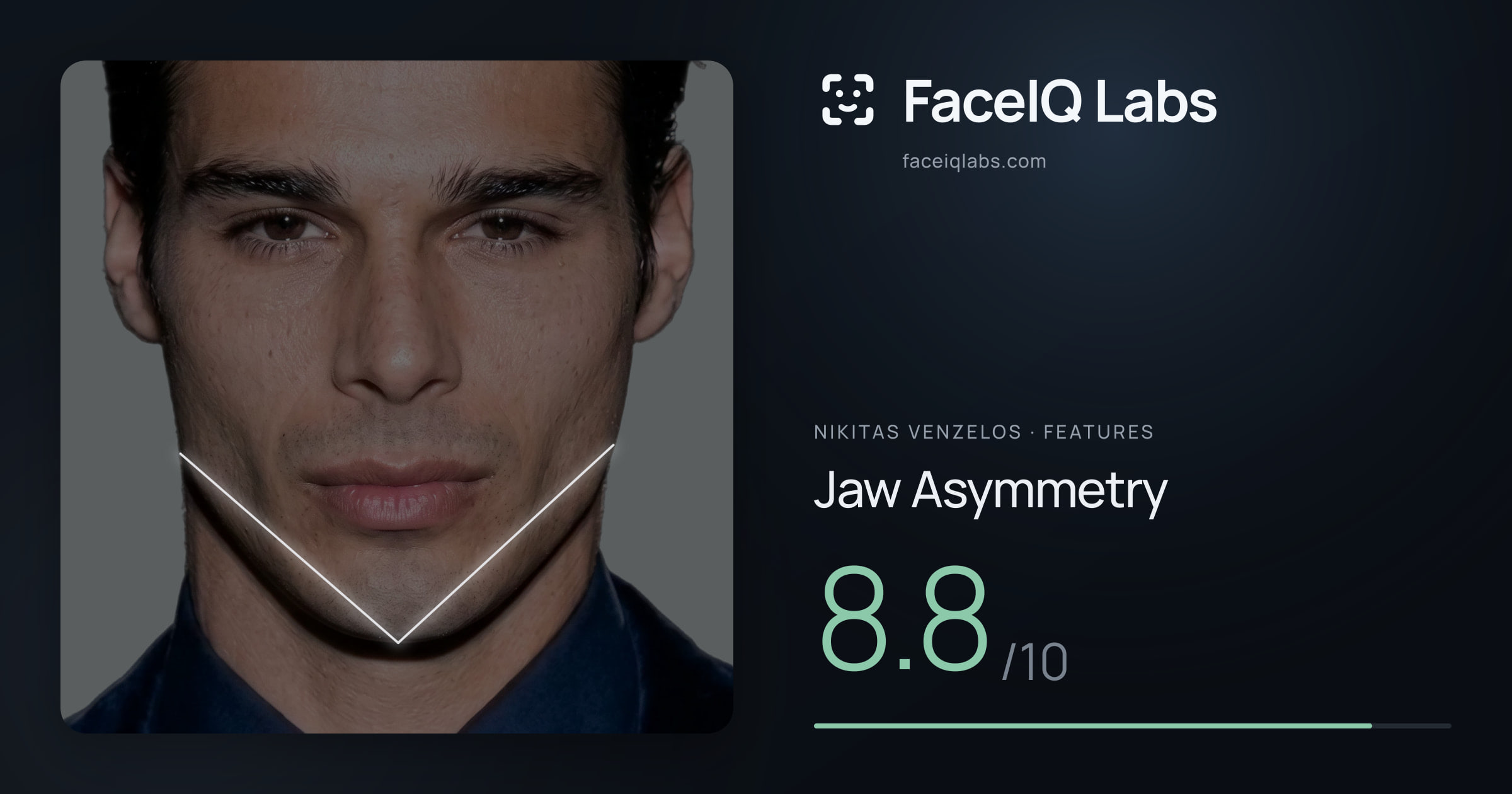 Nikitas Venzelos Jaw Asymmetry: 8.8/10, drawn on the photo