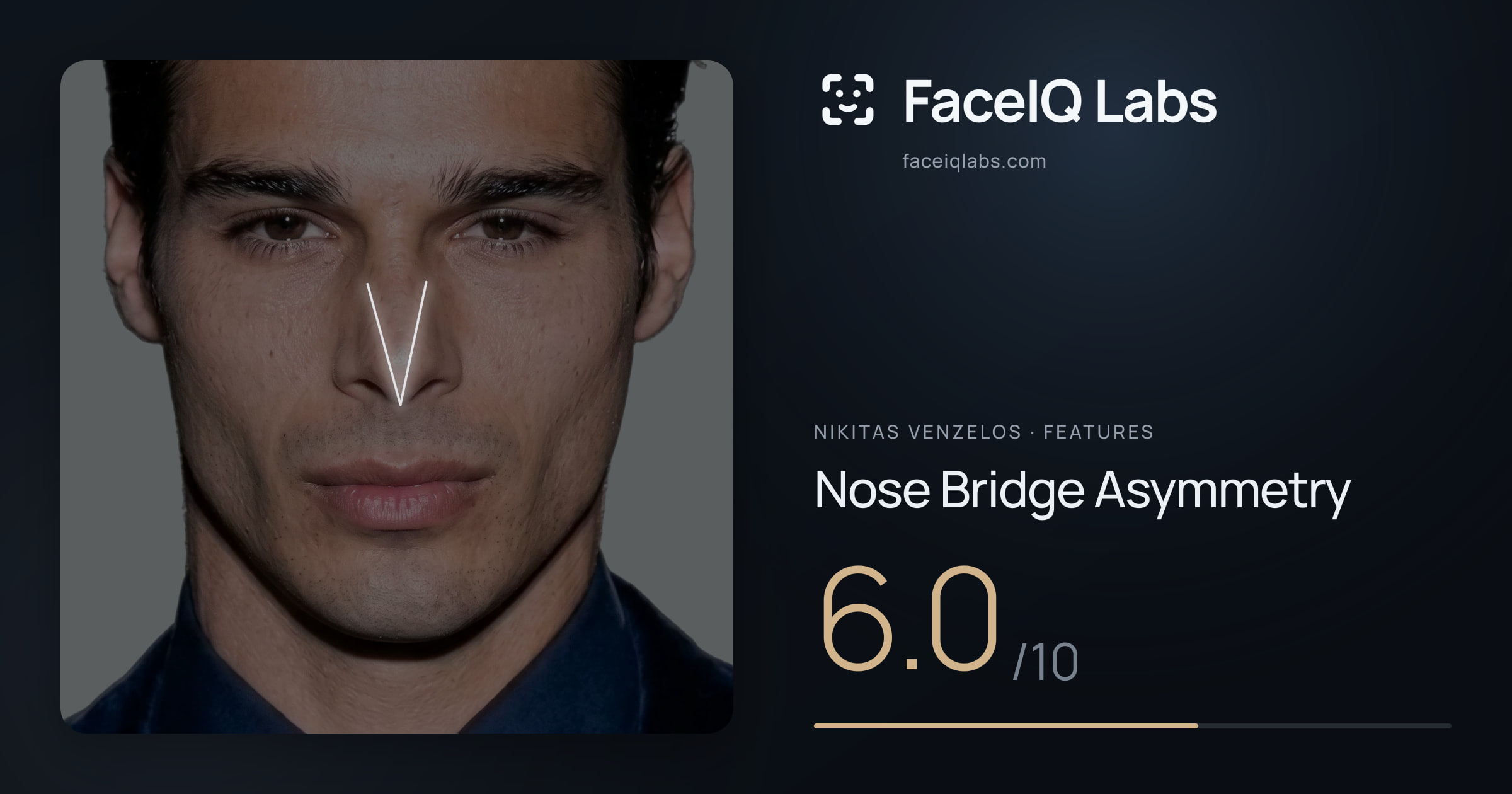 Nikitas Venzelos Nose Bridge Asymmetry: 6.0/10, drawn on the photo