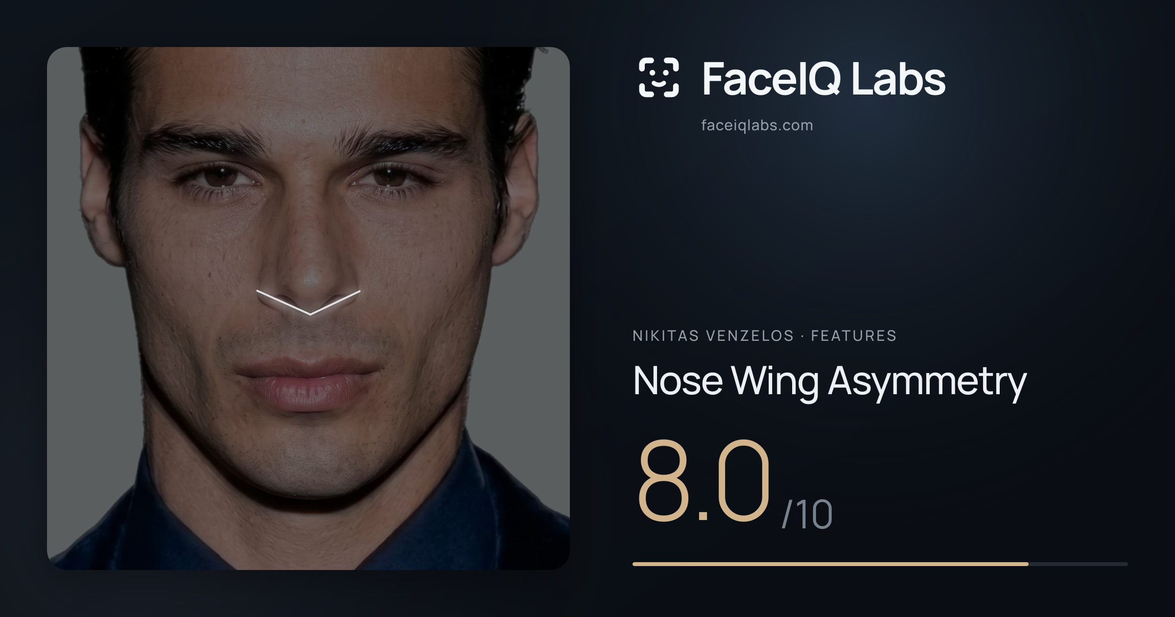 Nikitas Venzelos Nose Wing Asymmetry: 8.0/10, drawn on the photo