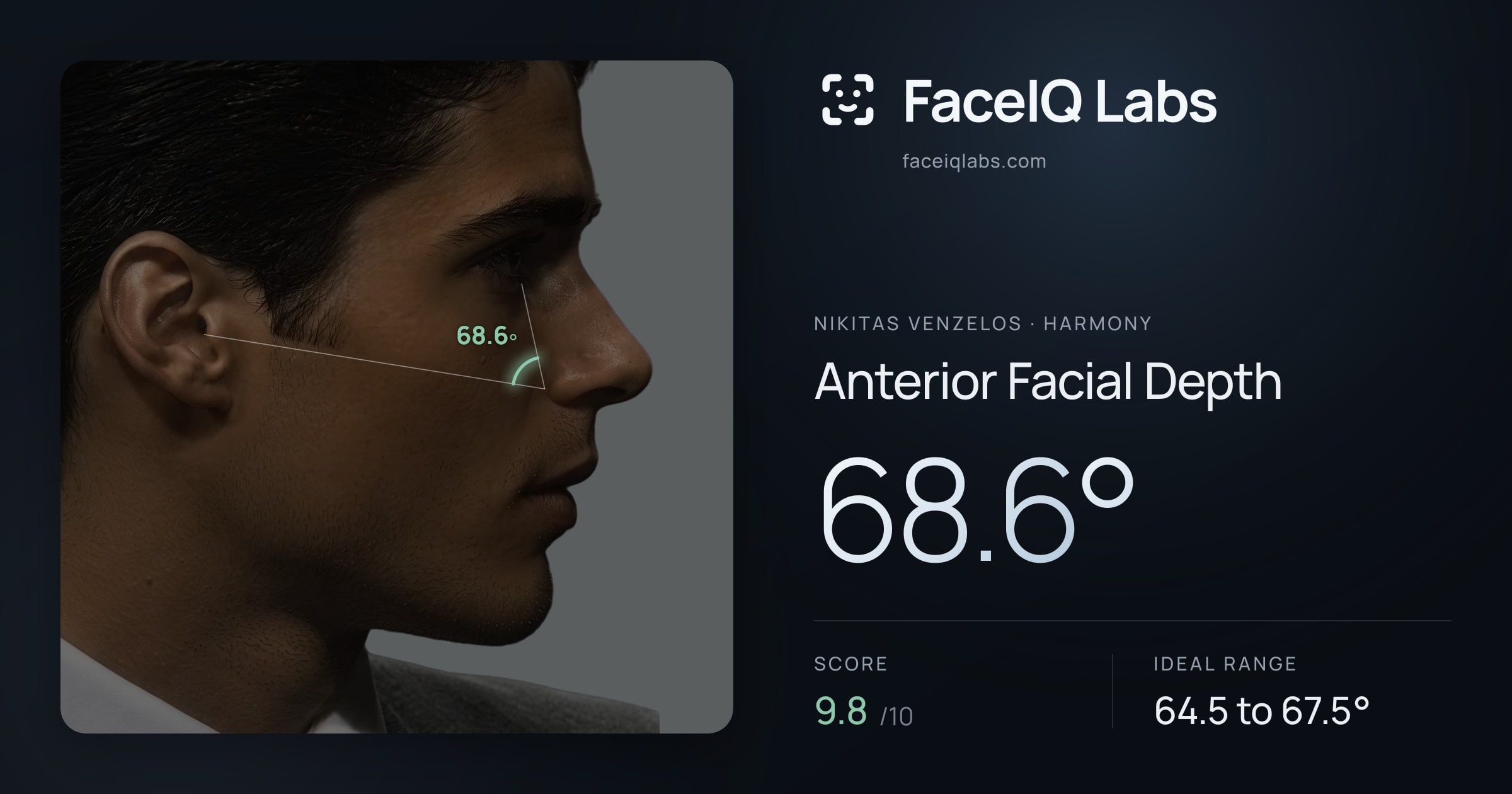Nikitas Venzelos Anterior Facial Depth: 68.6°, drawn on the photo