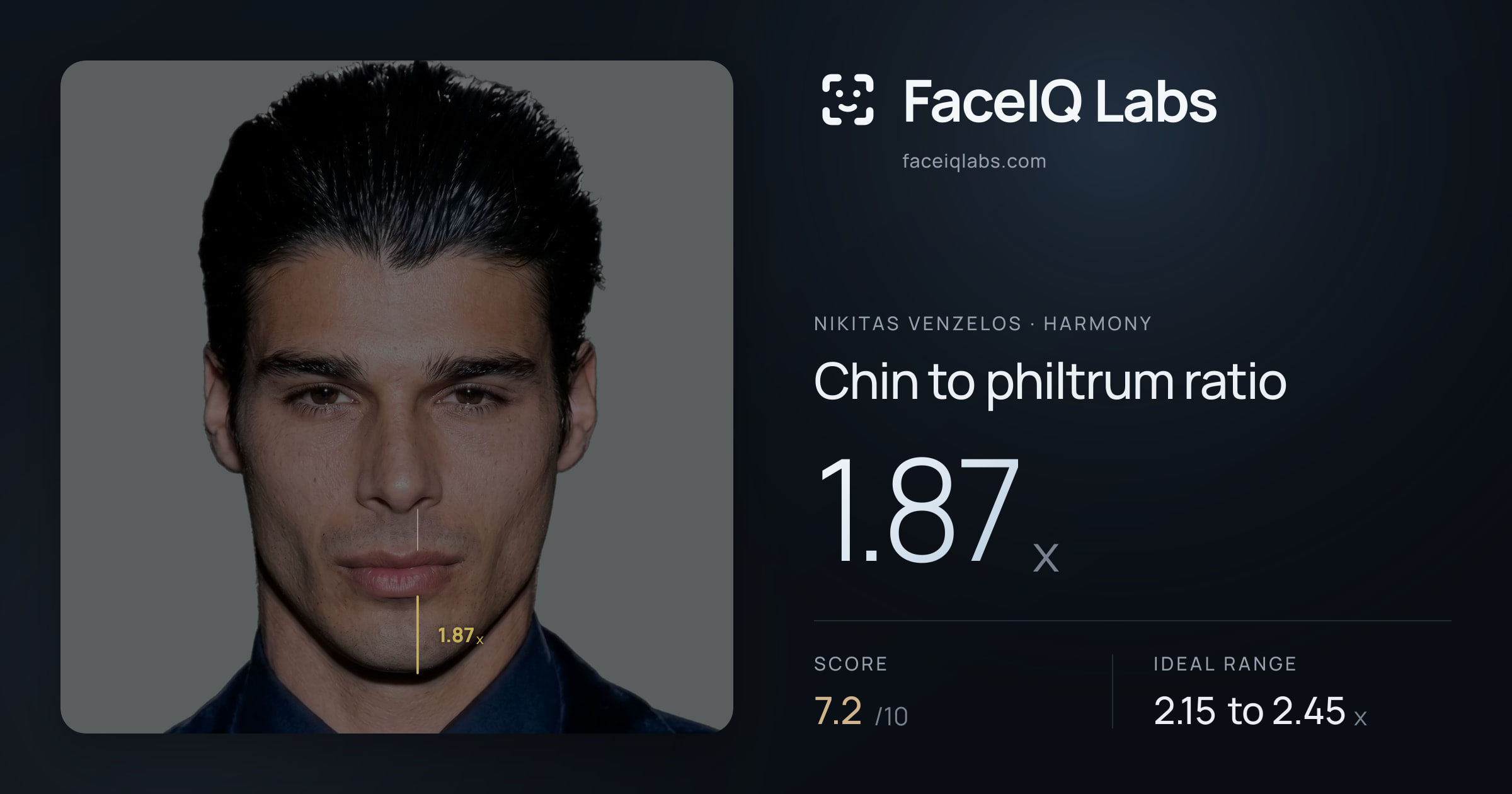 Nikitas Venzelos Chin to philtrum ratio: 1.87x, drawn on the photo