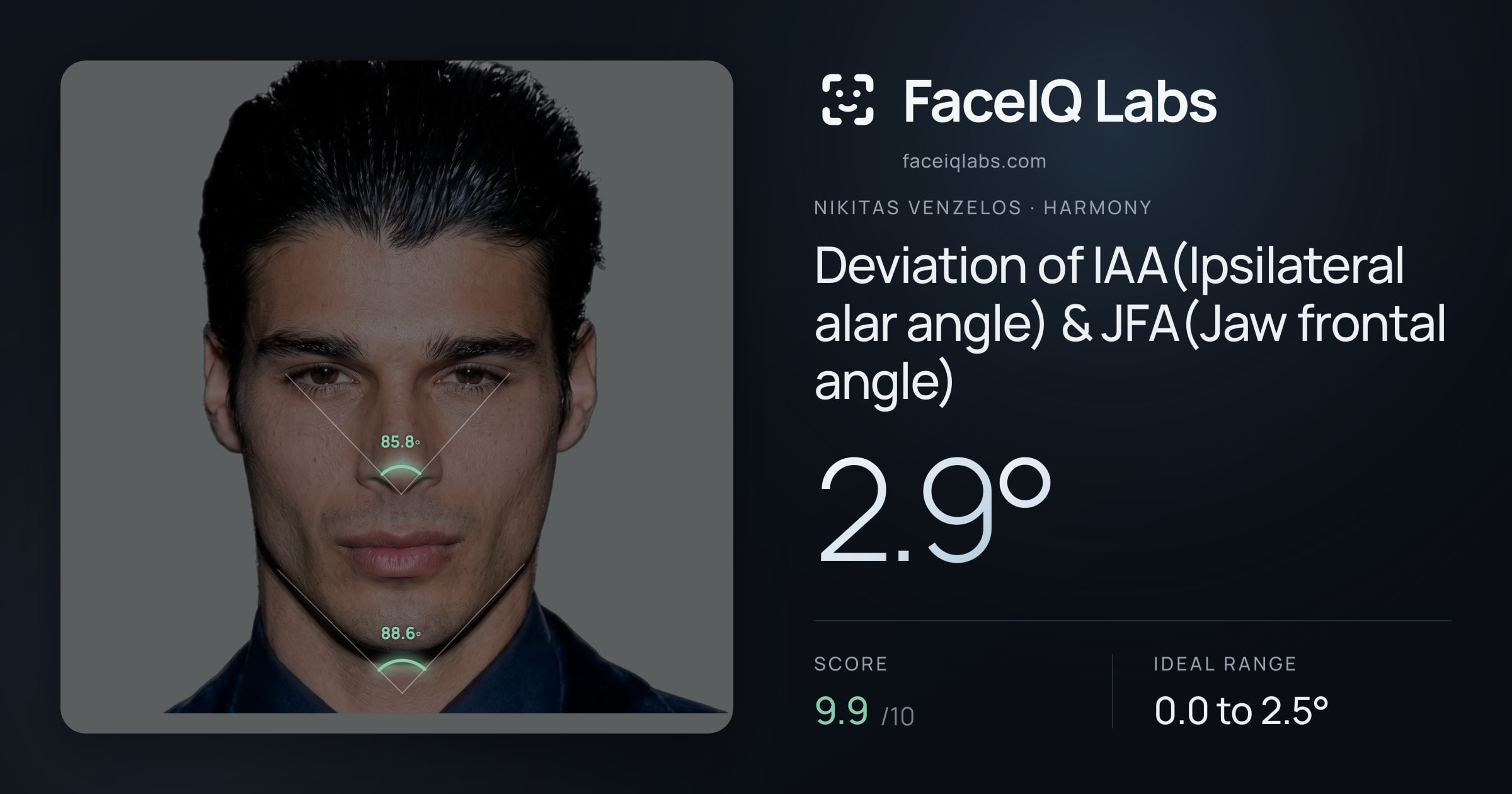 Nikitas Venzelos Deviation of IAA(Ipsilateral alar angle) & JFA(Jaw frontal angle): 2.9°, drawn on the photo