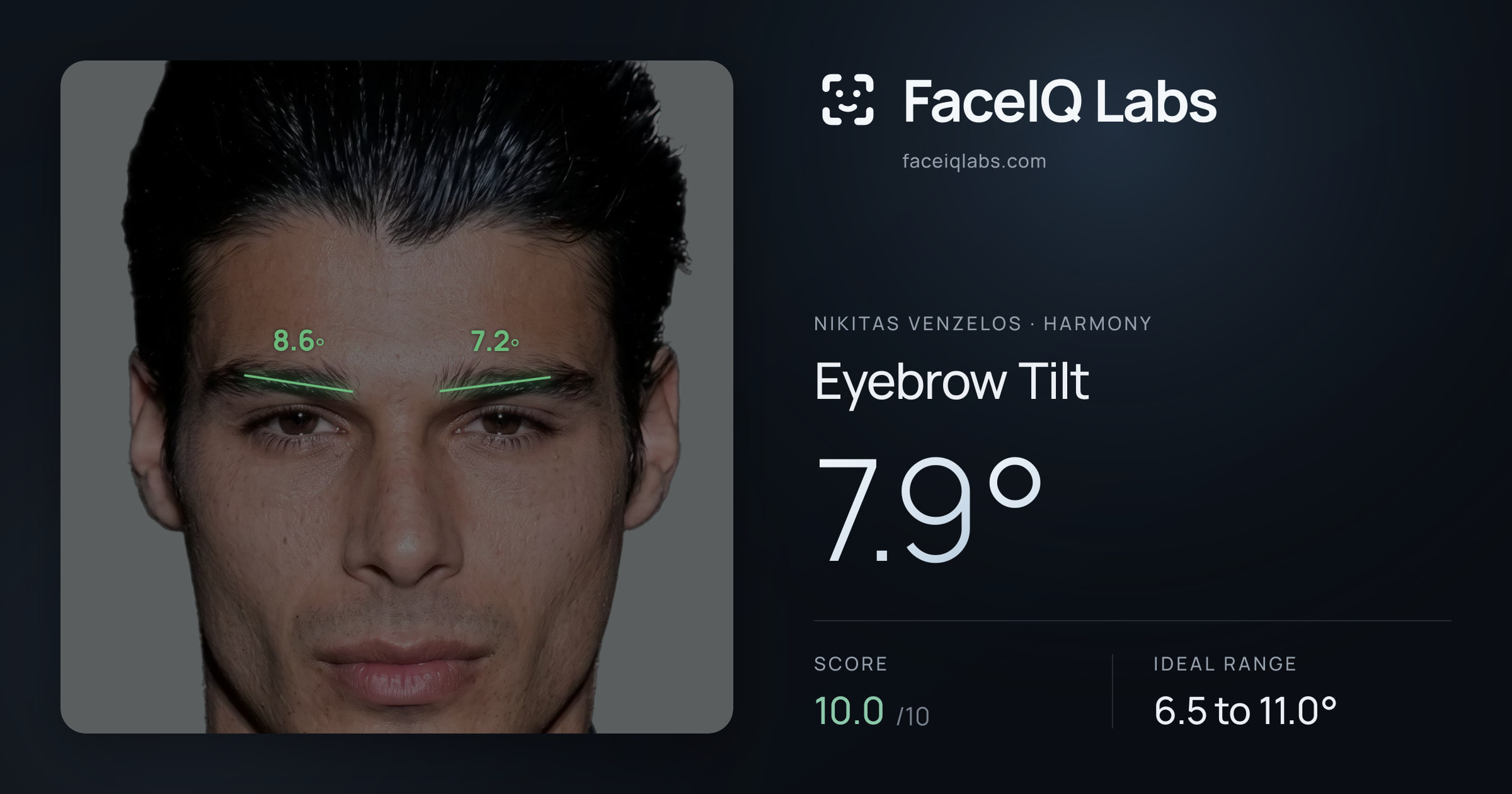 Nikitas Venzelos Eyebrow Tilt: 7.9°, drawn on the photo