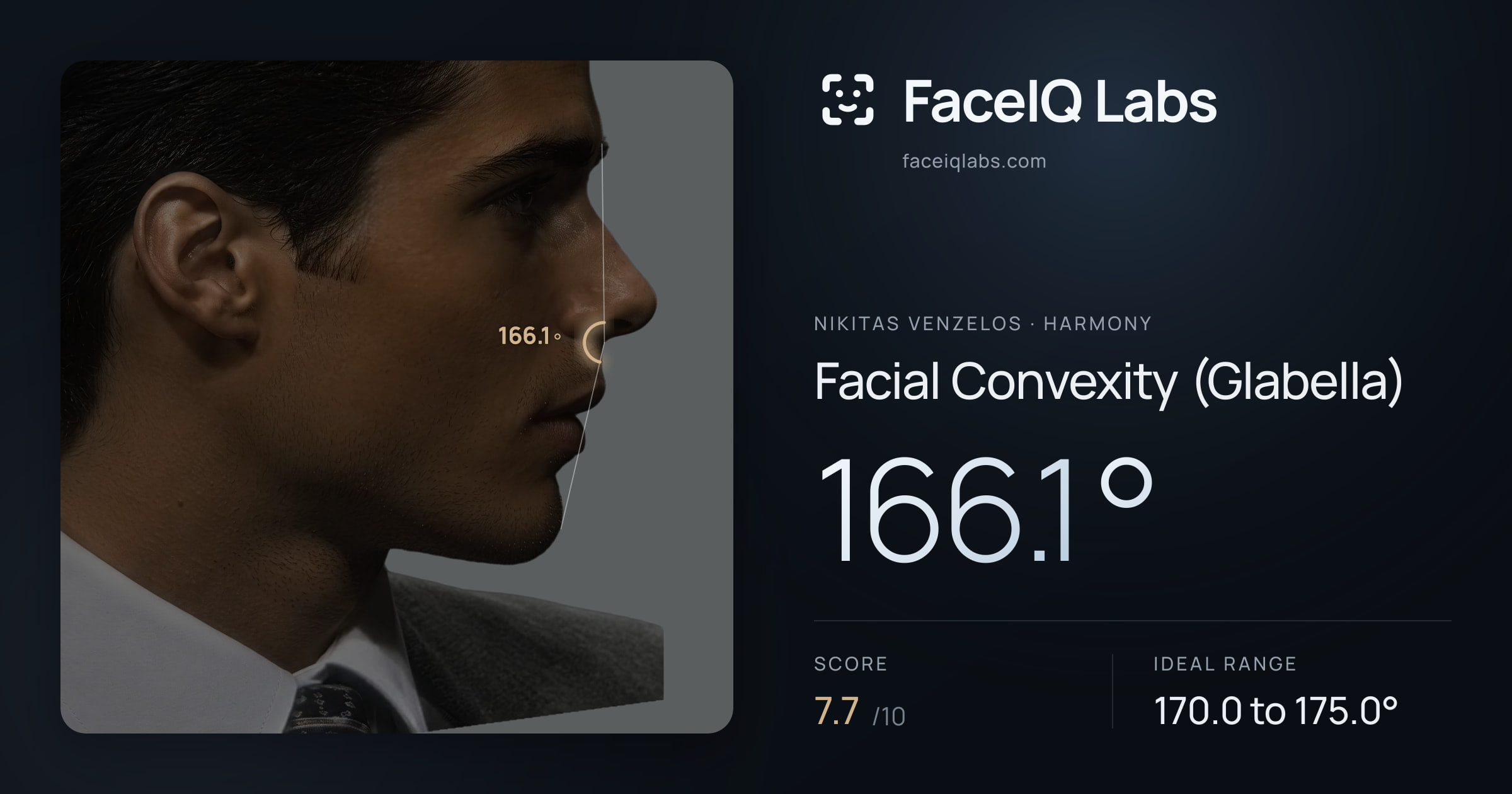 Nikitas Venzelos Facial Convexity (Glabella): 166.1°, drawn on the photo