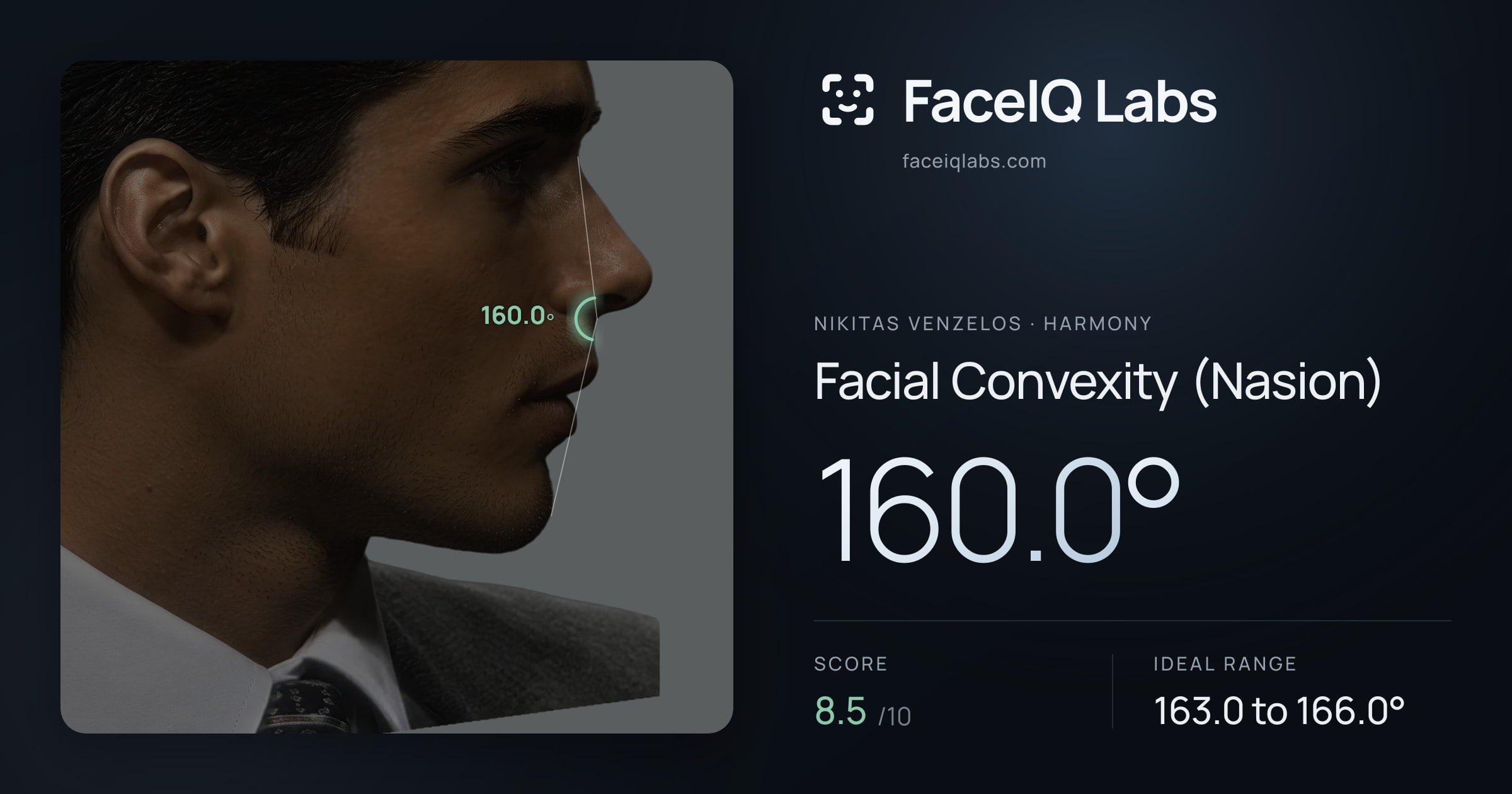 Nikitas Venzelos Facial Convexity (Nasion): 160.0°, drawn on the photo