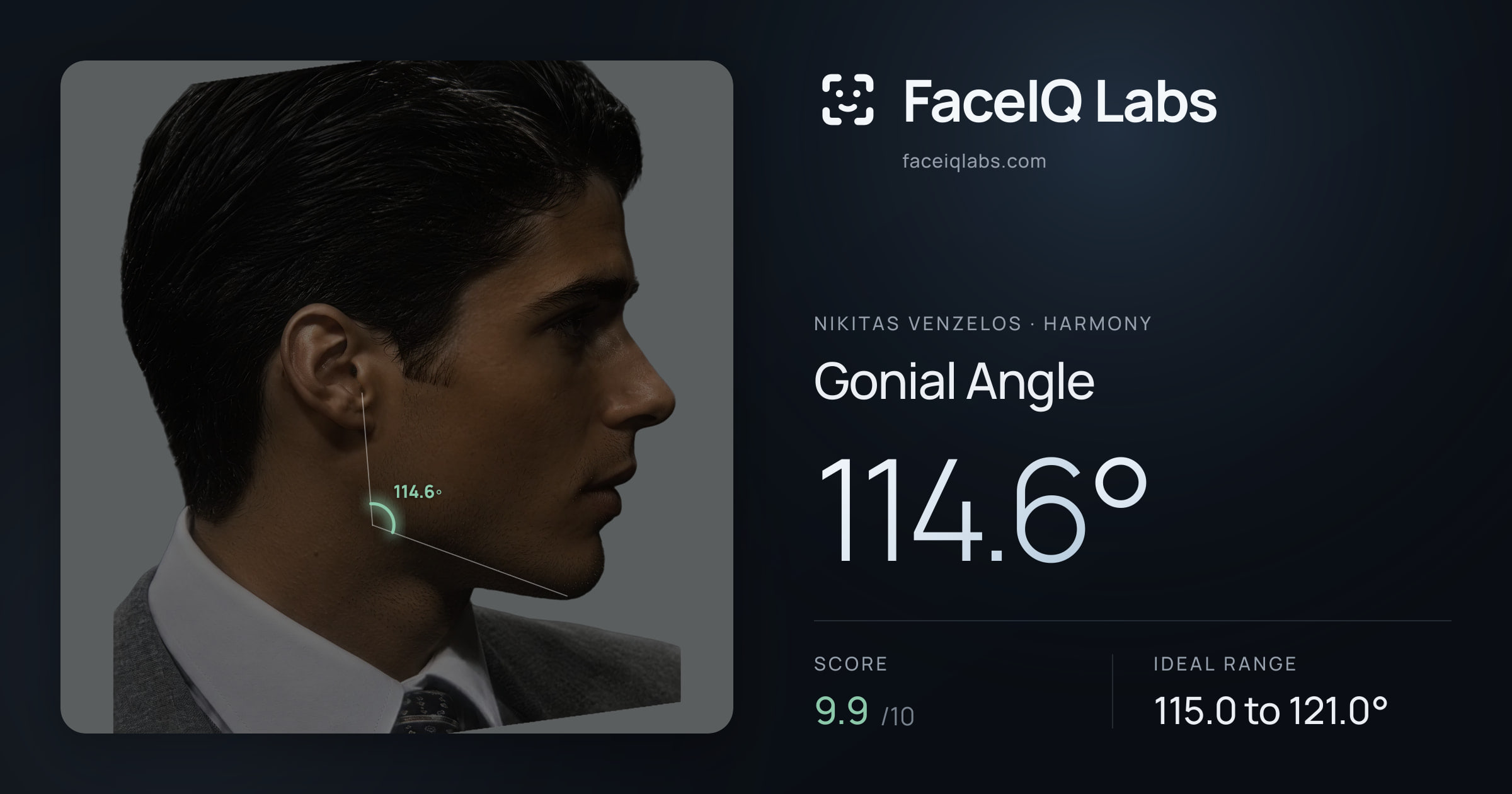 Nikitas Venzelos Gonial Angle: 114.6°, drawn on the photo