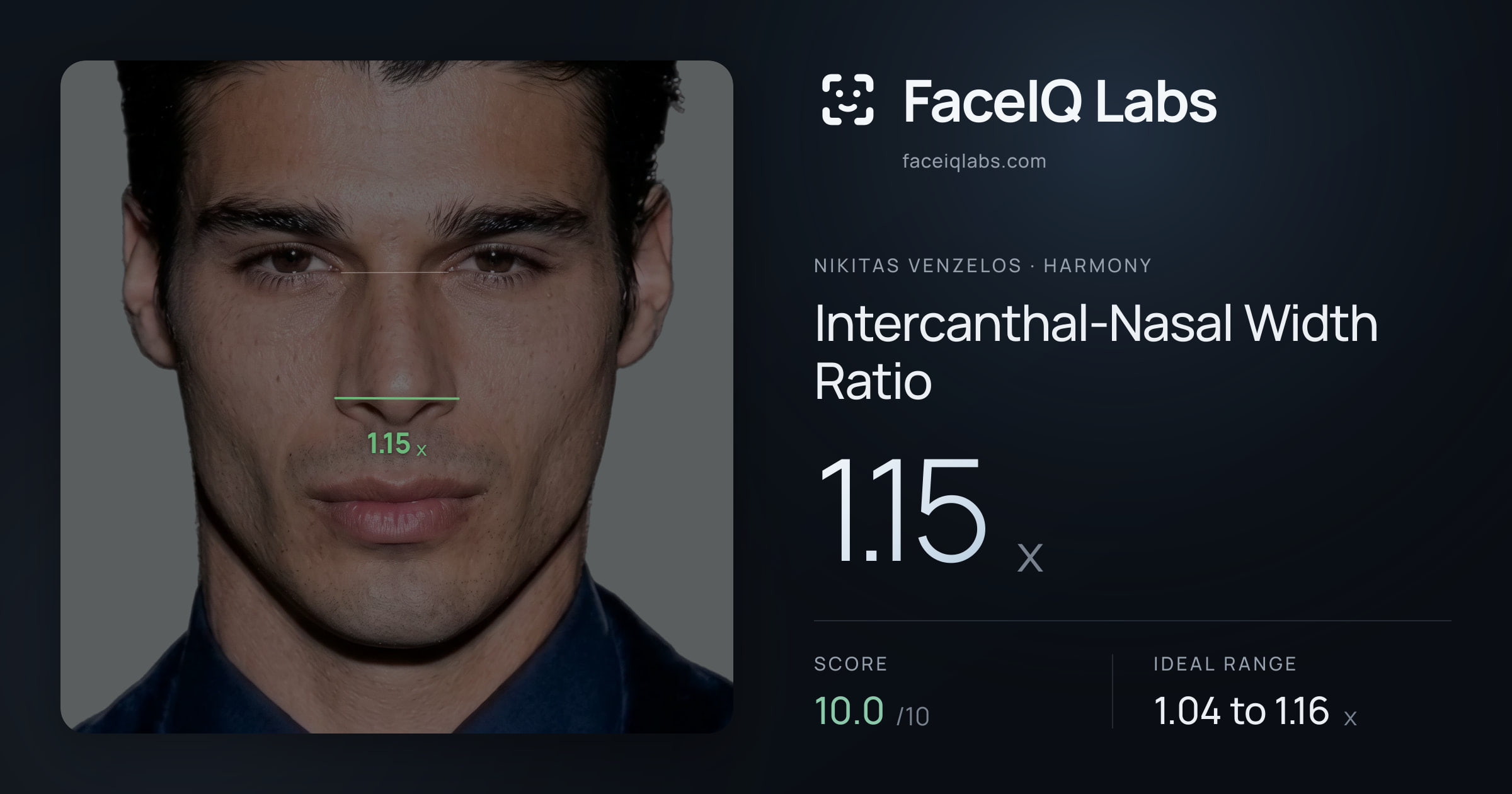 Nikitas Venzelos Intercanthal-Nasal Width Ratio: 1.15x, drawn on the photo