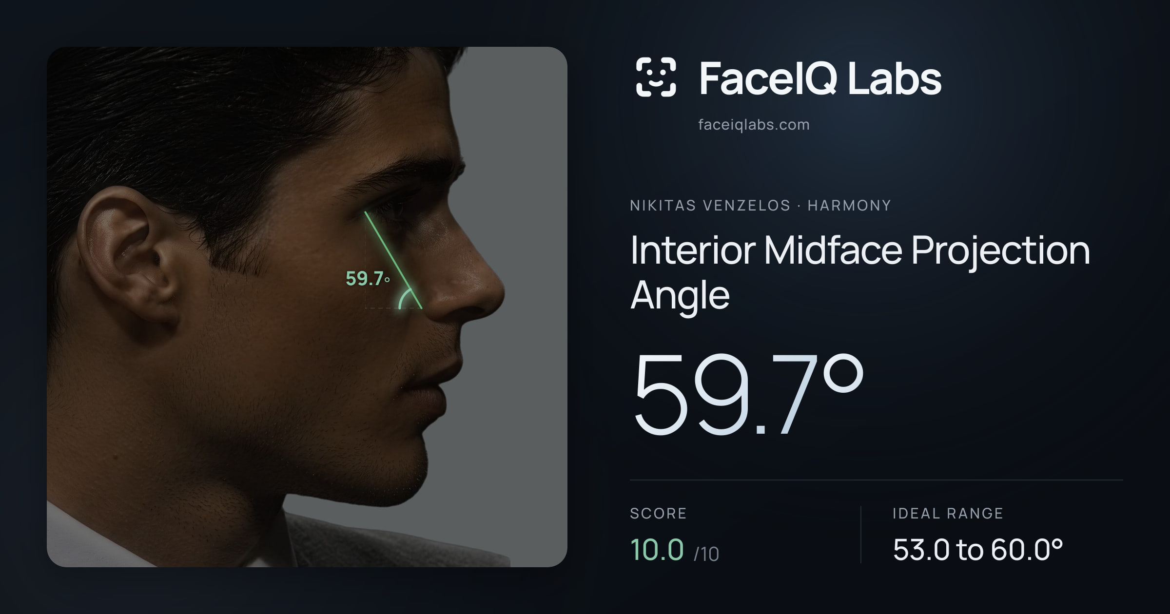 Nikitas Venzelos Interior Midface Projection Angle: 59.7°, drawn on the photo