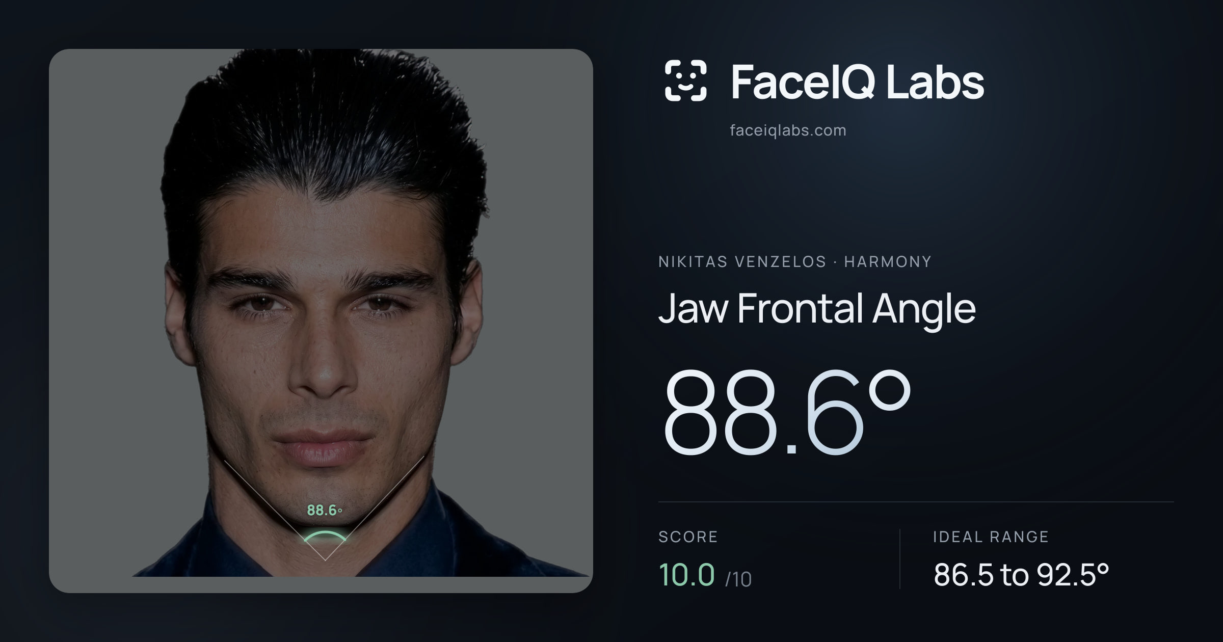 Nikitas Venzelos Jaw Frontal Angle: 88.6°, drawn on the photo