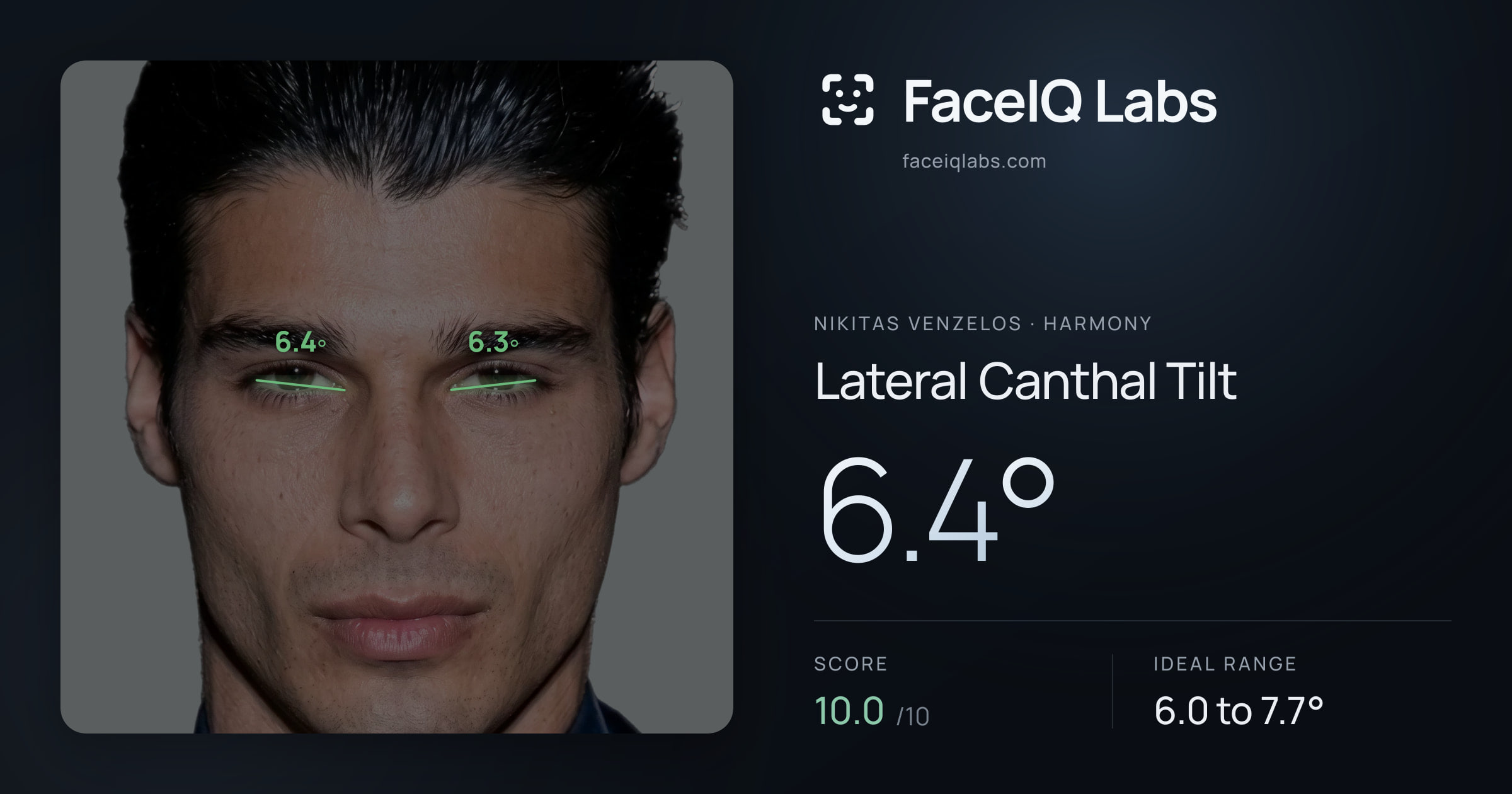 Nikitas Venzelos Lateral Canthal Tilt: 6.4°, drawn on the photo