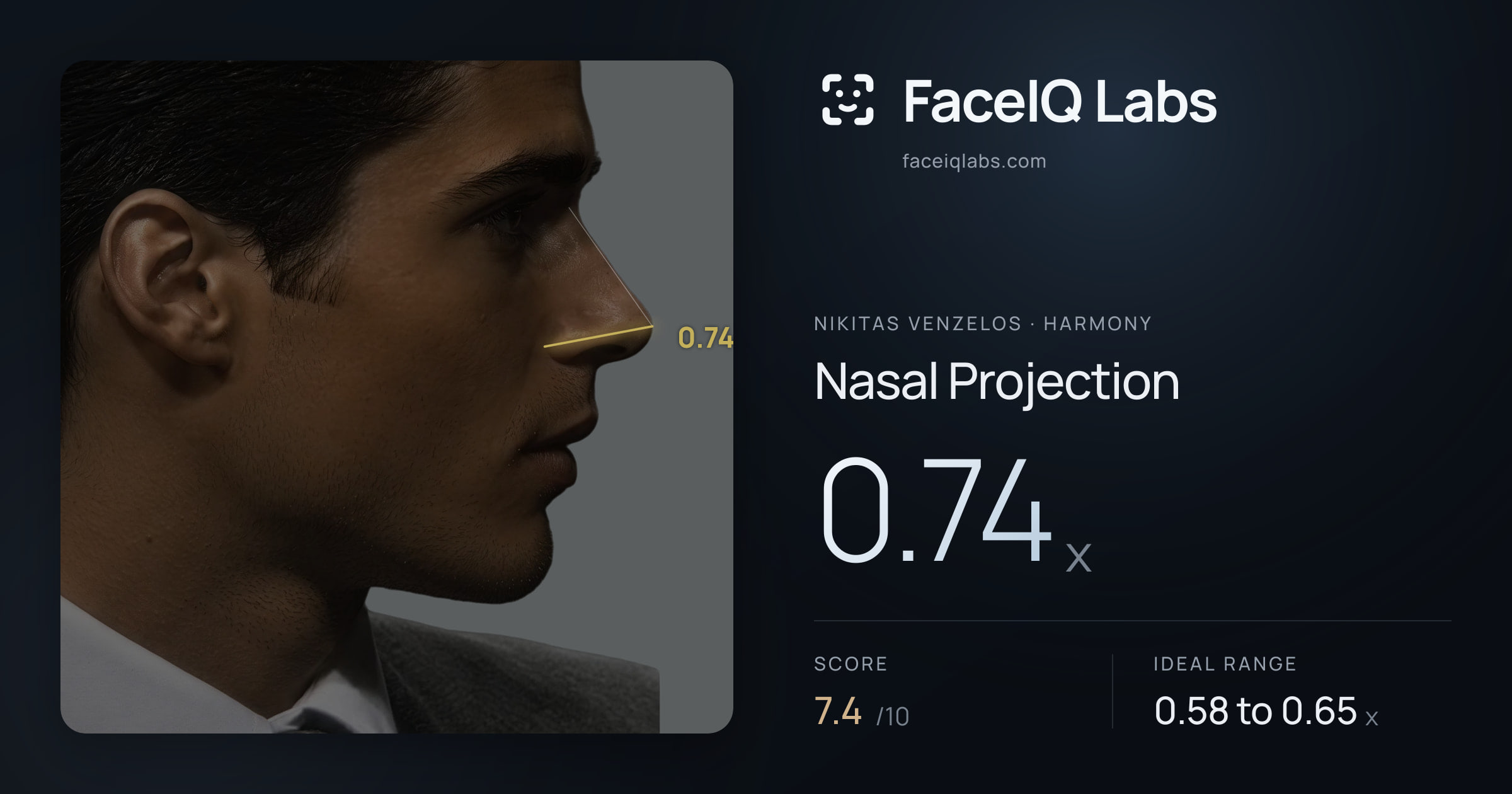 Nikitas Venzelos Nasal Projection: 0.74x, drawn on the photo