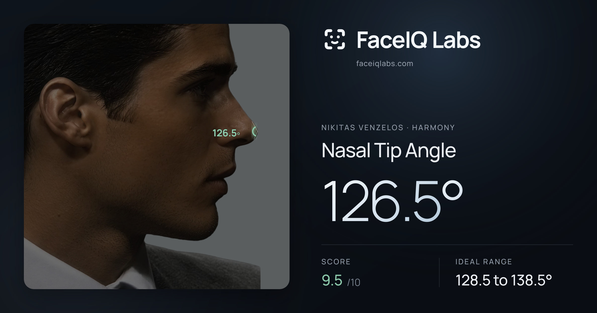 Nikitas Venzelos Nasal Tip Angle: 126.5°, drawn on the photo