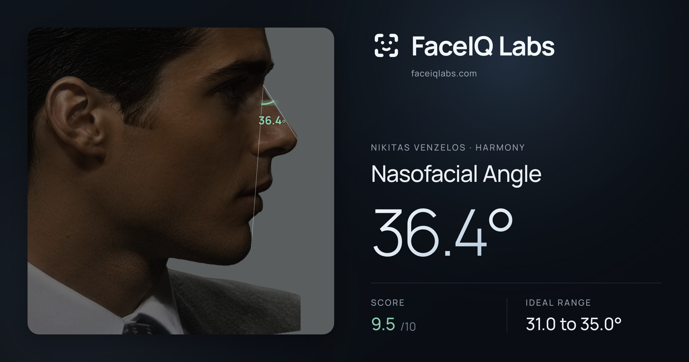 Nikitas Venzelos Nasofacial Angle: 36.4°, drawn on the photo