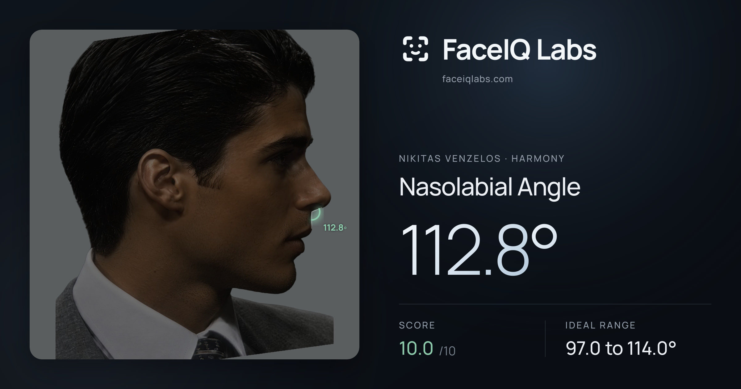 Nikitas Venzelos Nasolabial Angle: 112.8°, drawn on the photo