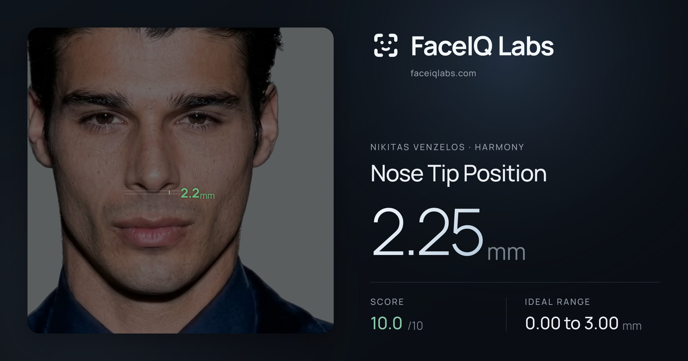 Nikitas Venzelos Nose Tip Position: 2.25mm, drawn on the photo
