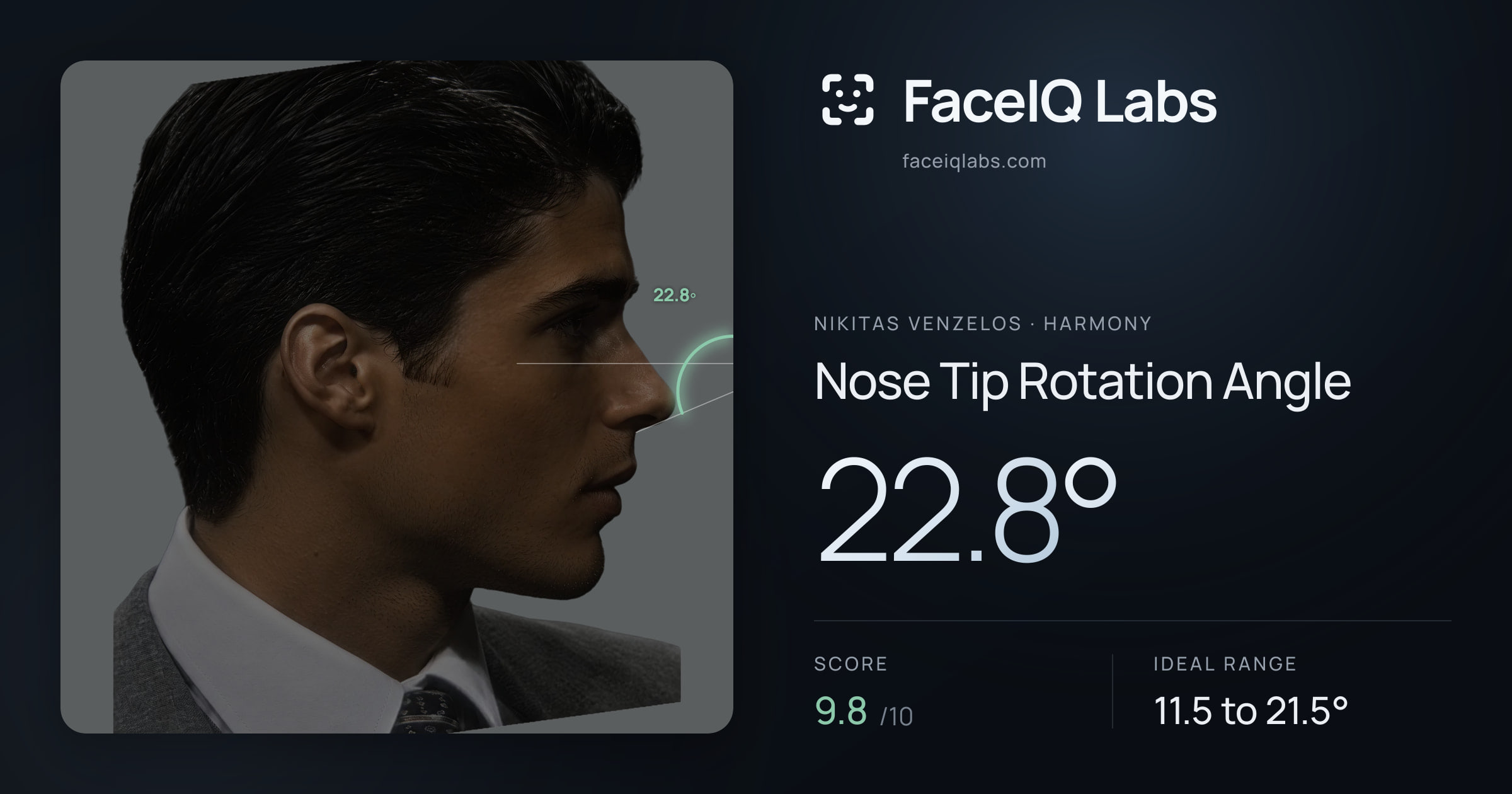 Nikitas Venzelos Nose Tip Rotation Angle: 22.8°, drawn on the photo