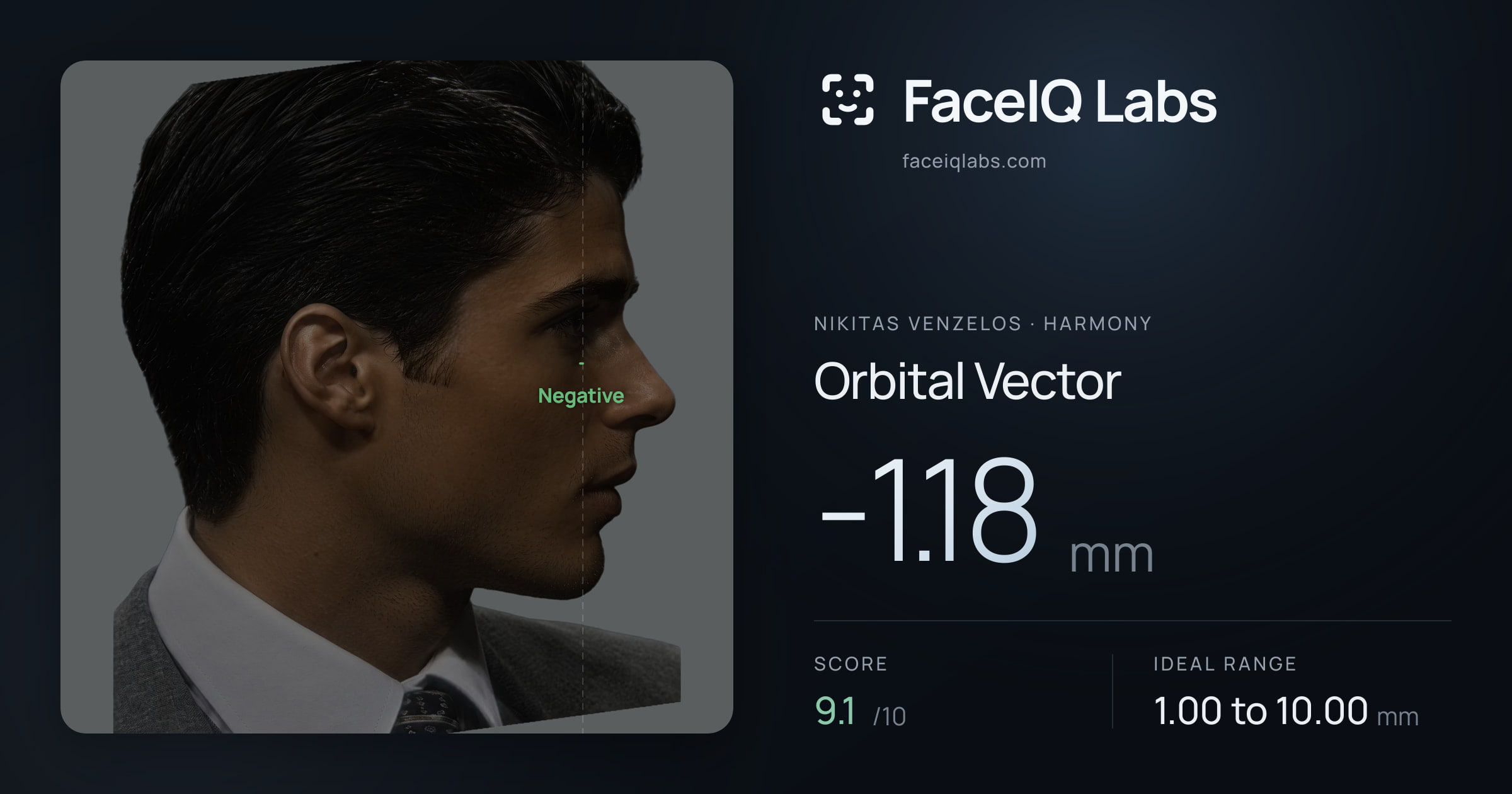 Nikitas Venzelos Orbital Vector: -1.18mm, drawn on the photo