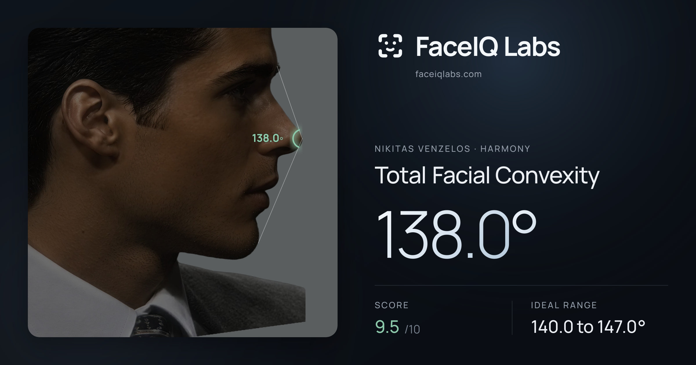 Nikitas Venzelos Total Facial Convexity: 138.0°, drawn on the photo