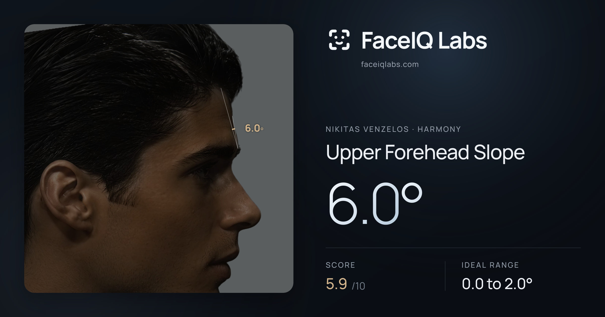 Nikitas Venzelos Upper Forehead Slope: 6.0°, drawn on the photo