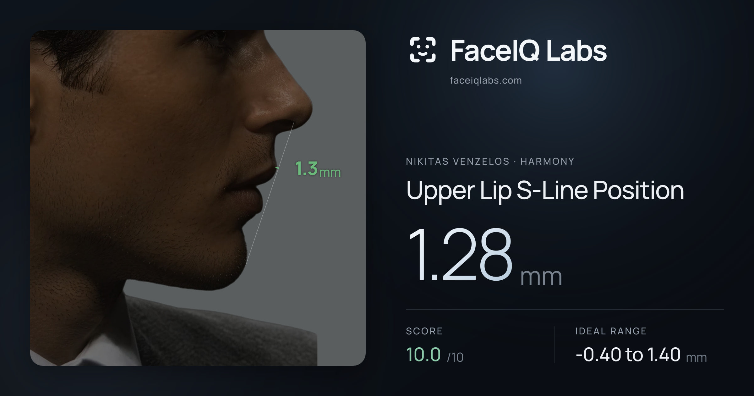 Nikitas Venzelos Upper Lip S-Line Position: 1.28mm, drawn on the photo