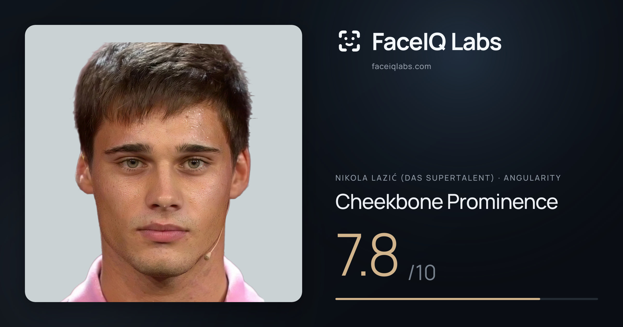 Nikola Lazić (Das Supertalent) Cheekbone Prominence: 7.8/10, drawn on the photo