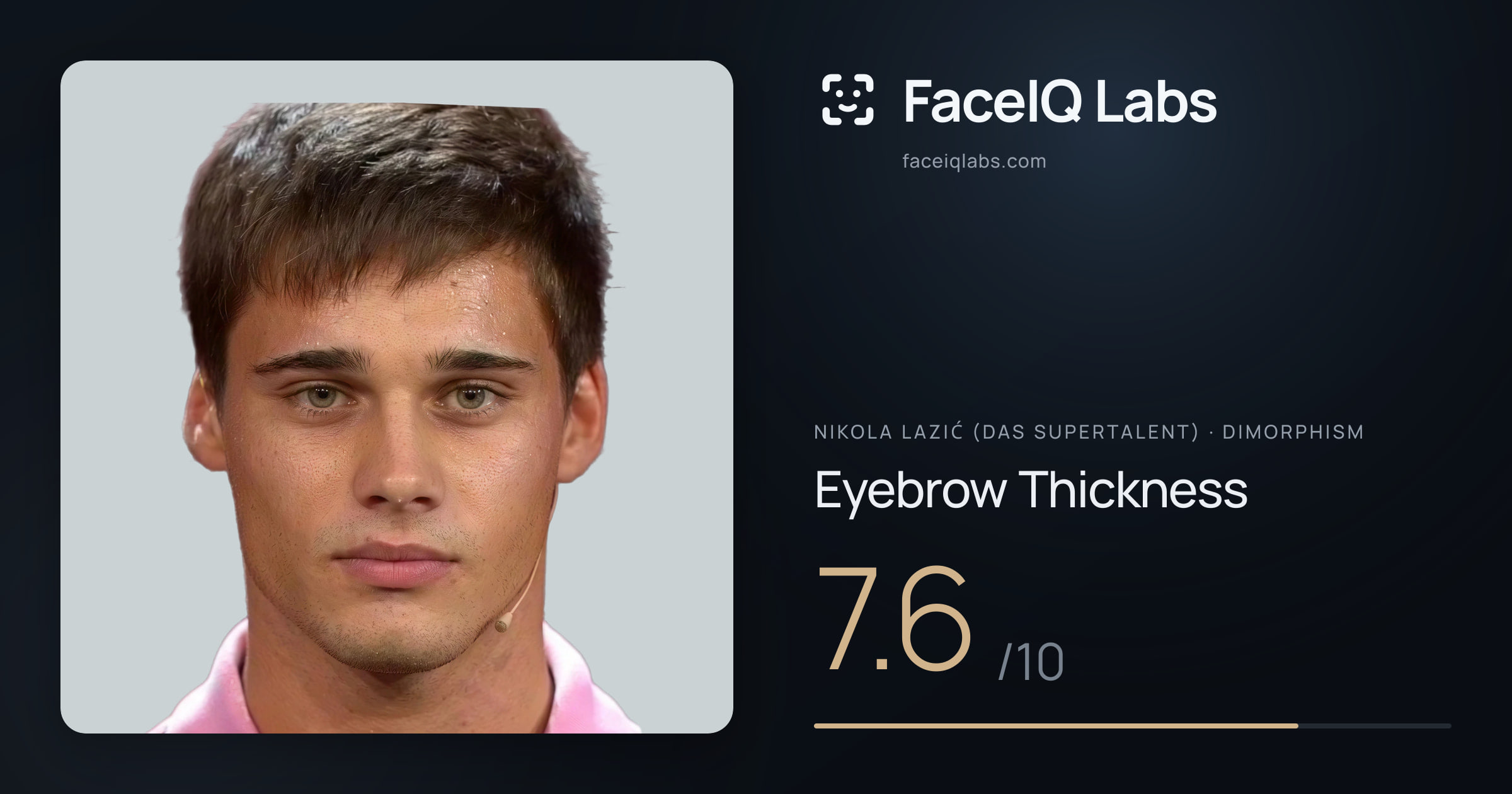 Nikola Lazić (Das Supertalent) Eyebrow Thickness: 7.6/10, drawn on the photo