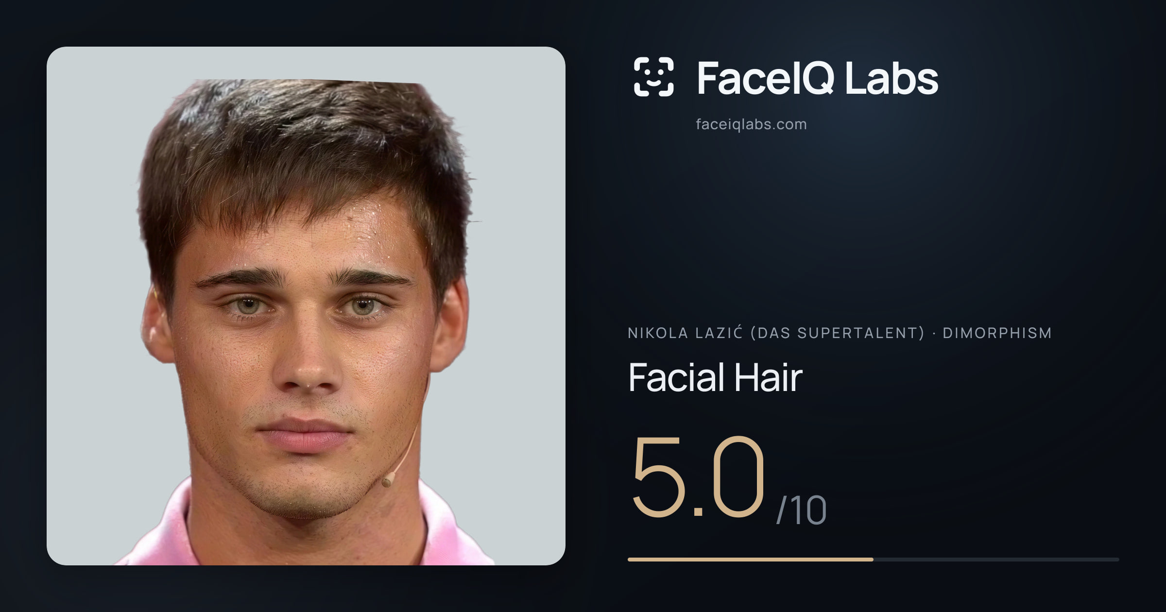 Nikola Lazić (Das Supertalent) Facial Hair: 5.0/10, drawn on the photo