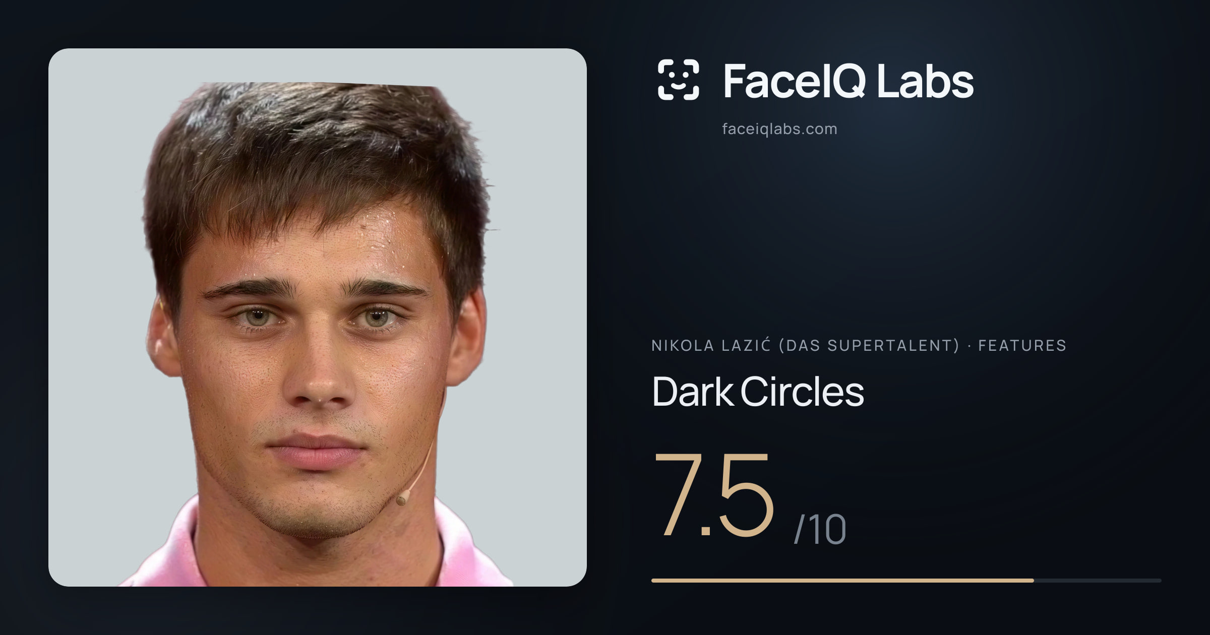 Nikola Lazić (Das Supertalent) Dark Circles: 7.5/10, drawn on the photo