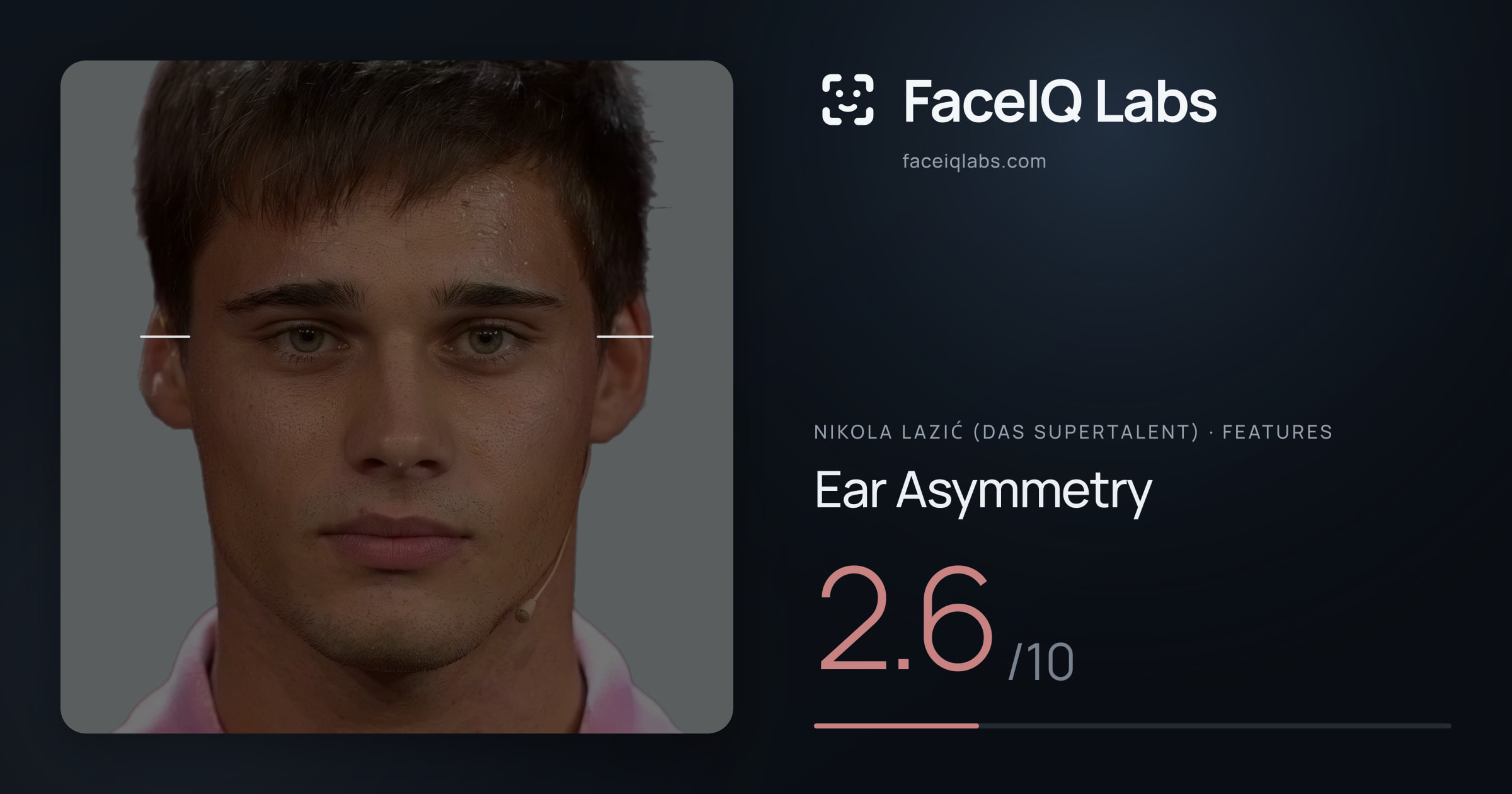 Nikola Lazić (Das Supertalent) Ear Asymmetry: 2.6/10, drawn on the photo