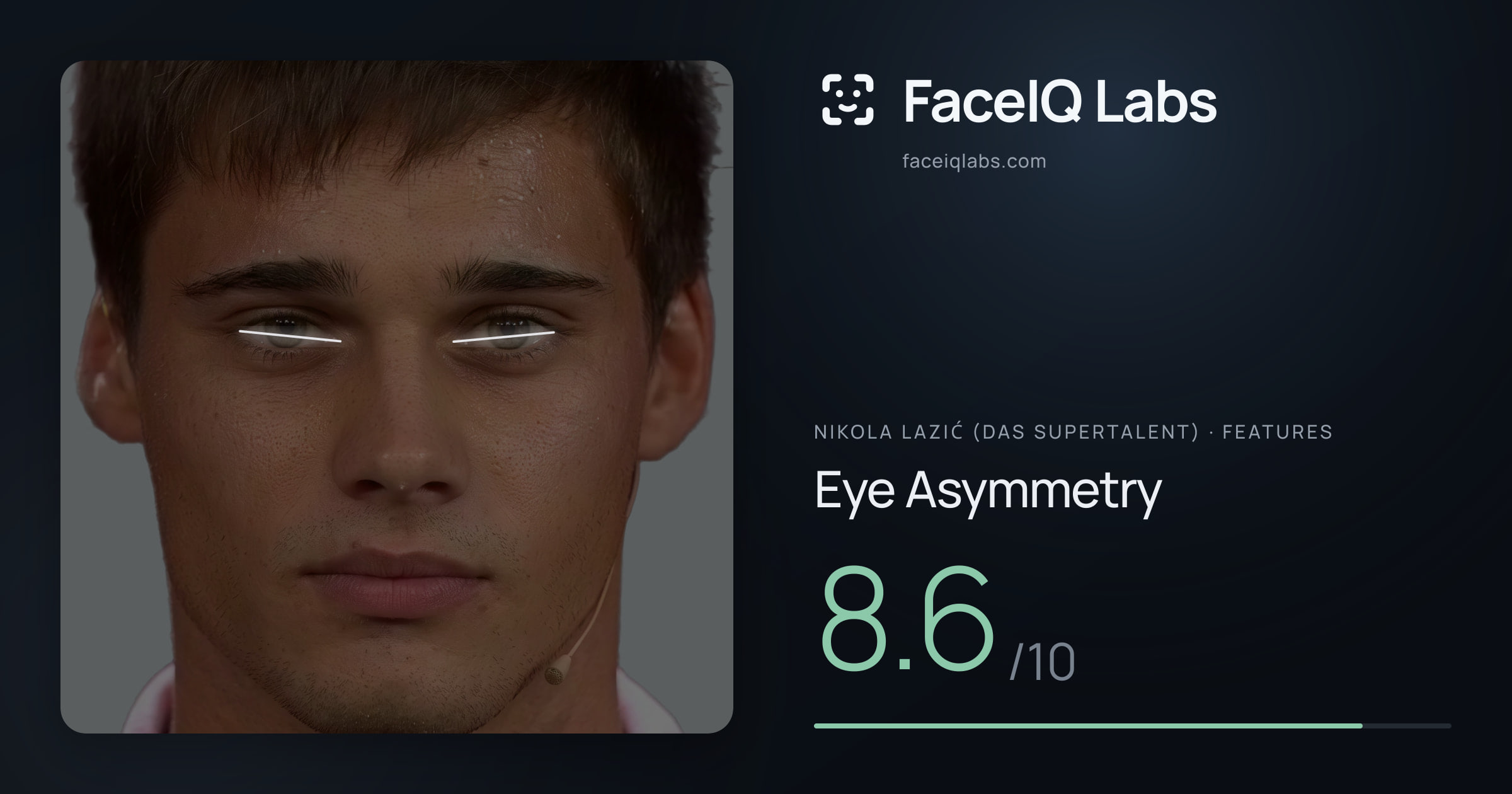 Nikola Lazić (Das Supertalent) Eye Asymmetry: 8.6/10, drawn on the photo