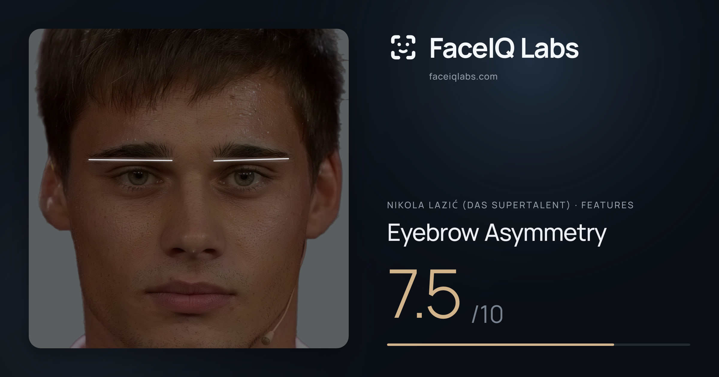 Nikola Lazić (Das Supertalent) Eyebrow Asymmetry: 7.5/10, drawn on the photo