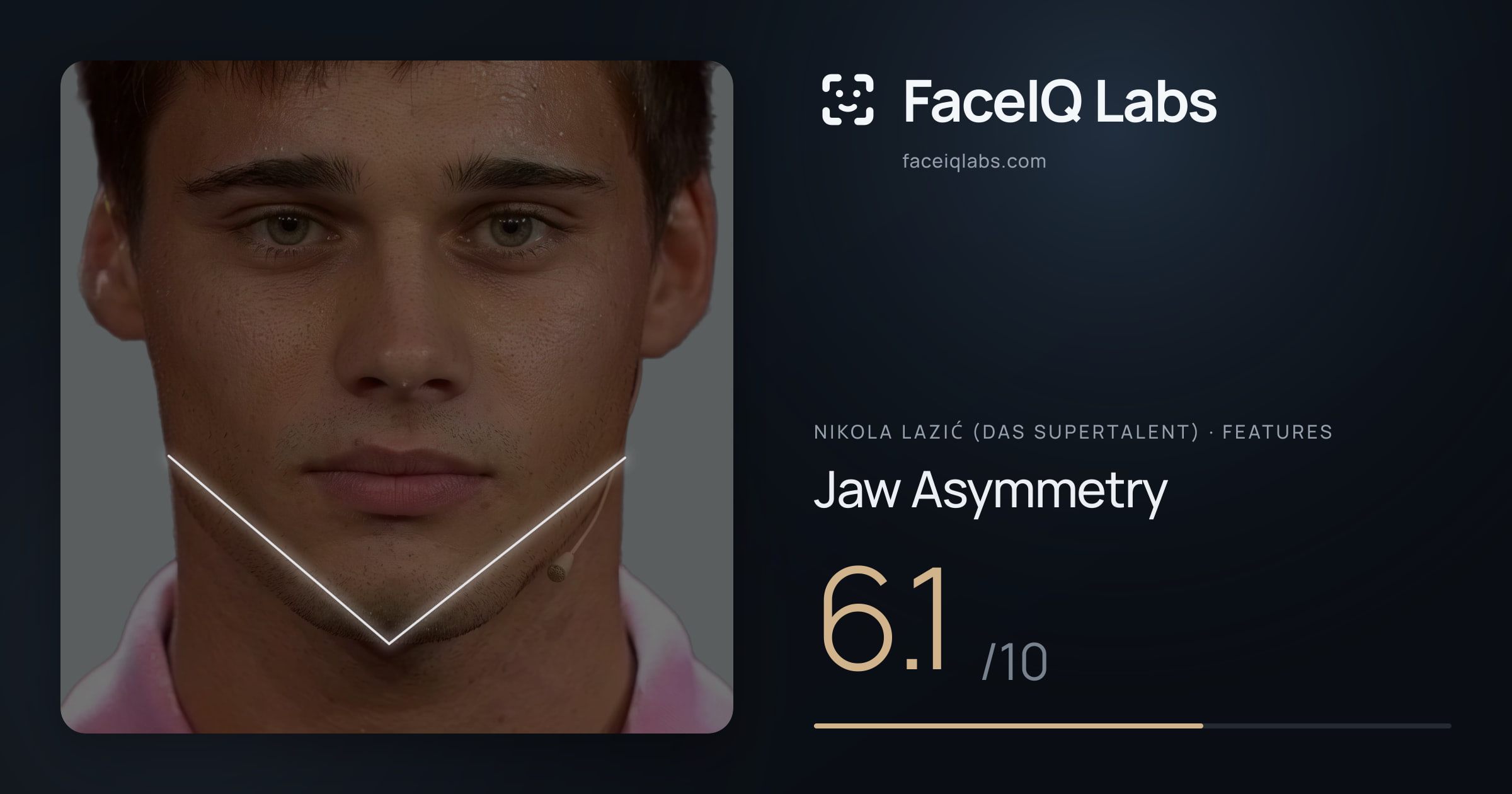 Nikola Lazić (Das Supertalent) Jaw Asymmetry: 6.1/10, drawn on the photo