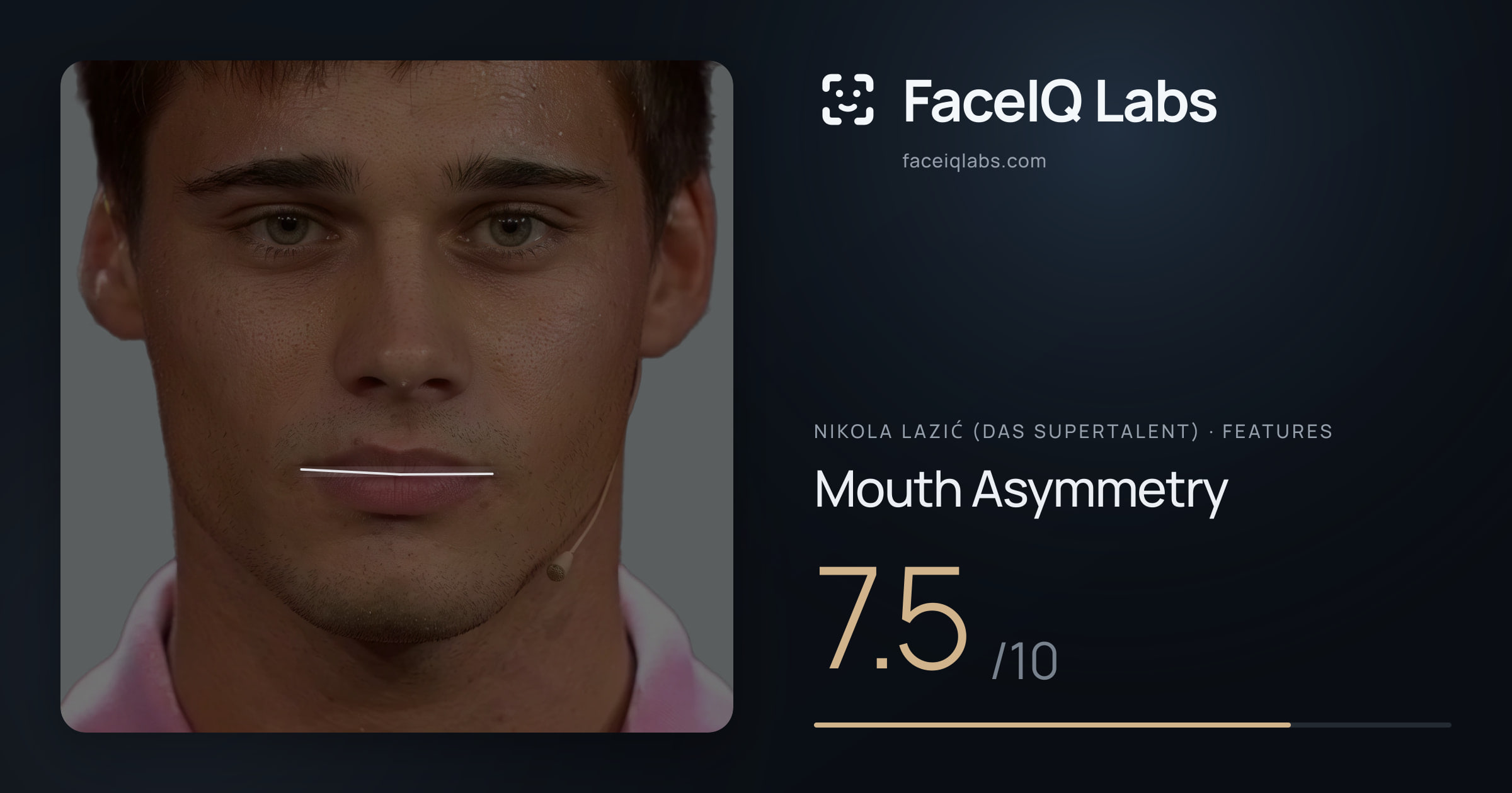 Nikola Lazić (Das Supertalent) Mouth Asymmetry: 7.5/10, drawn on the photo