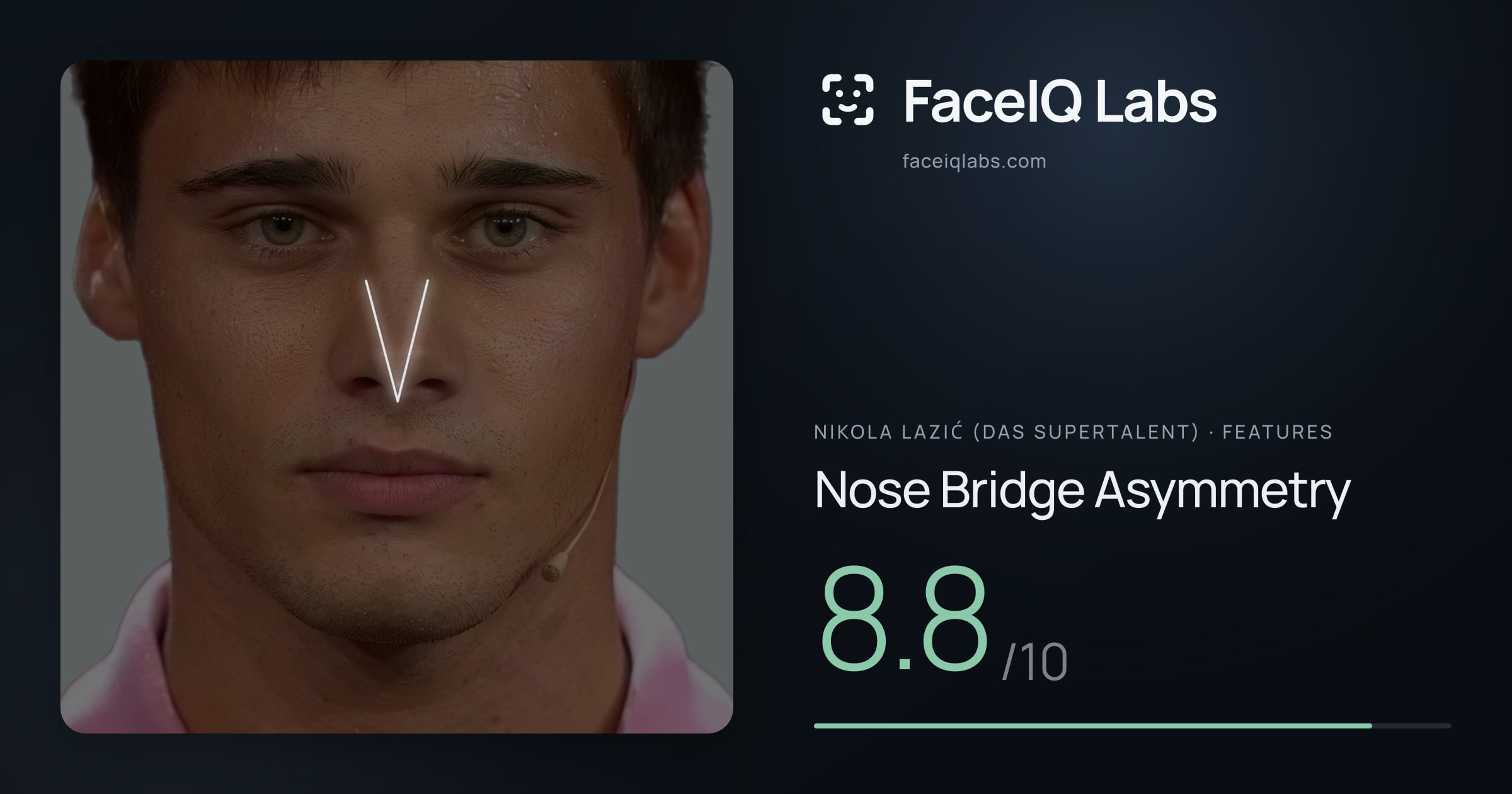 Nikola Lazić (Das Supertalent) Nose Bridge Asymmetry: 8.8/10, drawn on the photo