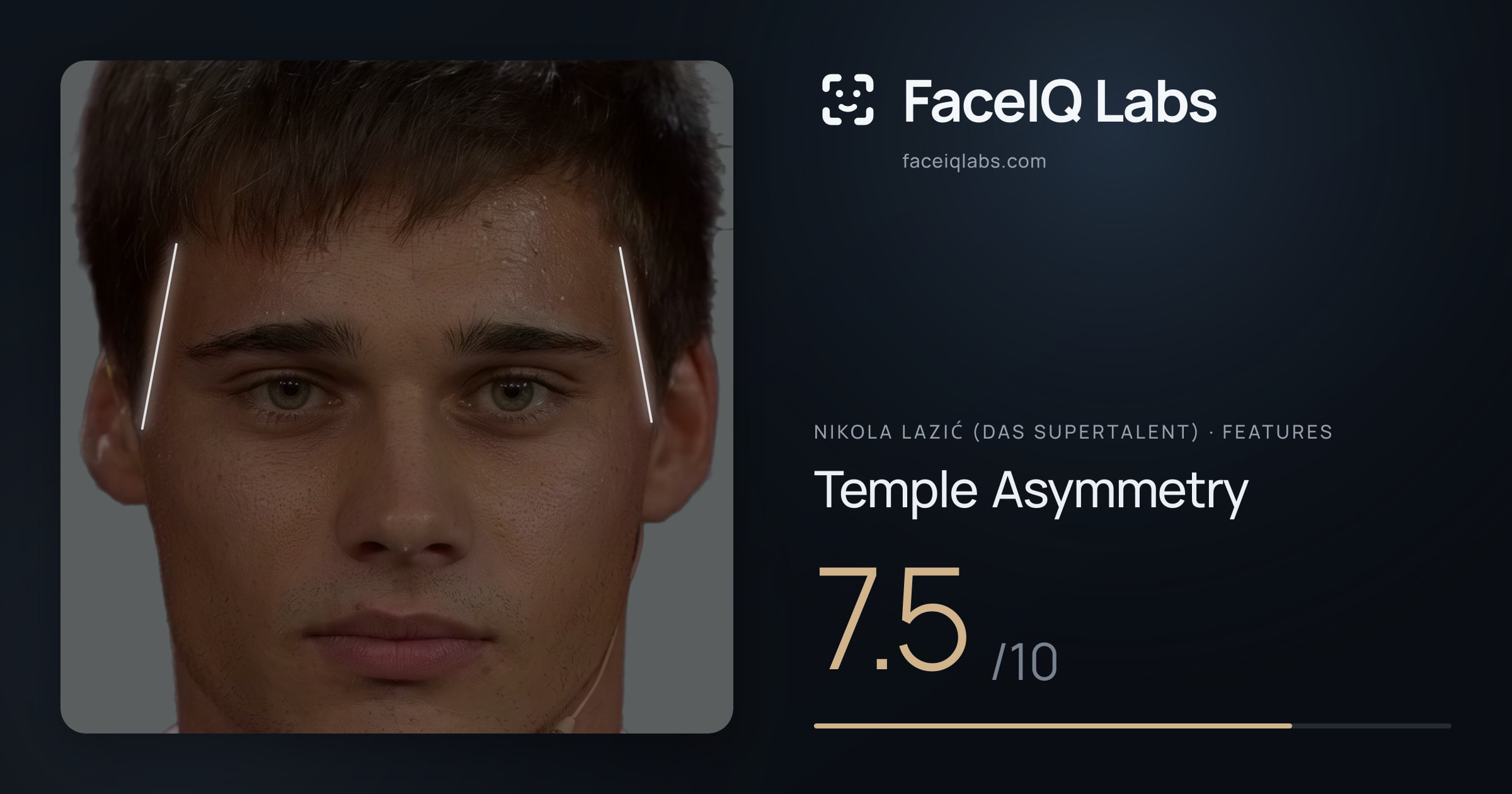 Nikola Lazić (Das Supertalent) Temple Asymmetry: 7.5/10, drawn on the photo