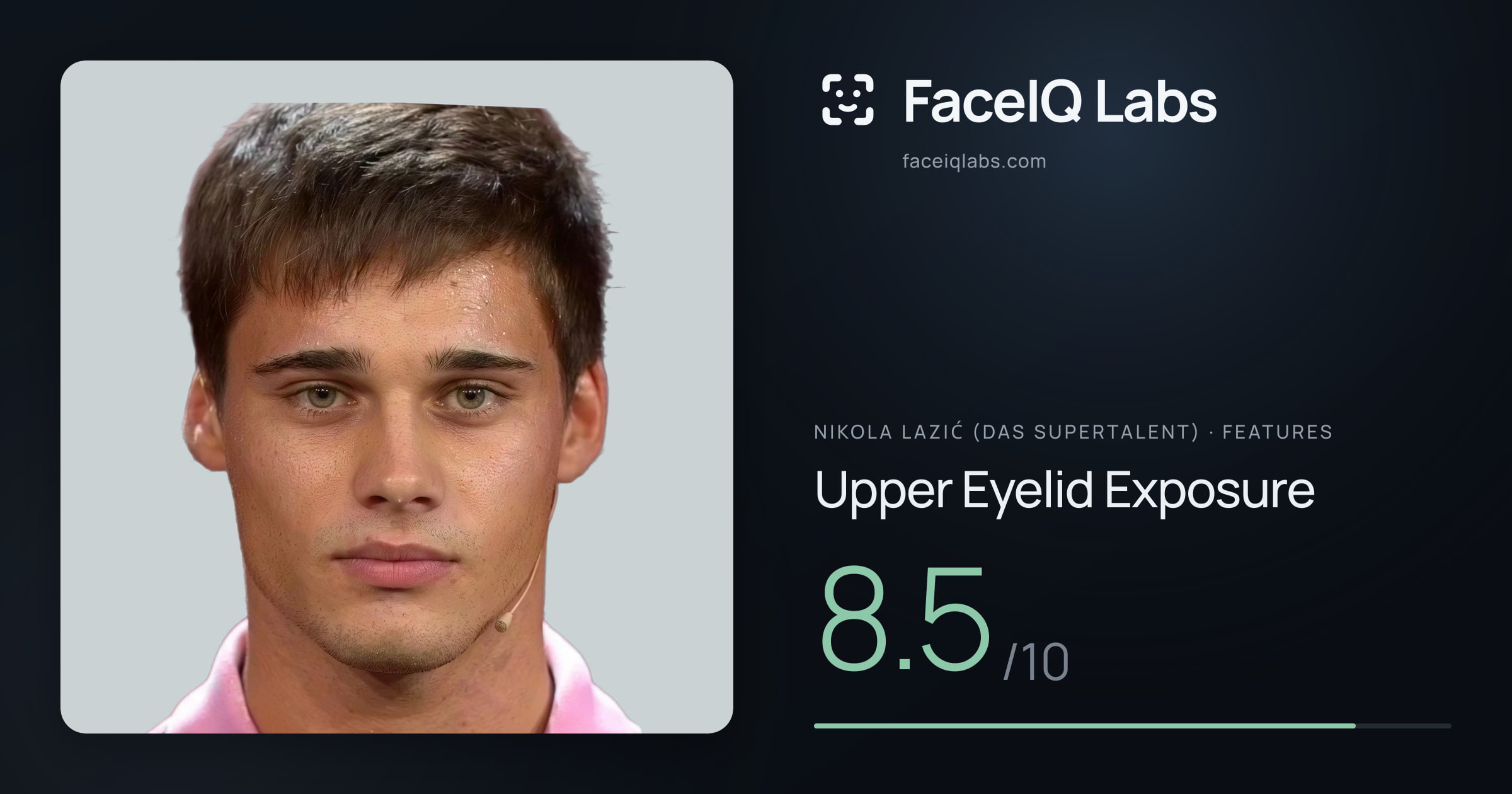 Nikola Lazić (Das Supertalent) Upper Eyelid Exposure: 8.5/10, drawn on the photo