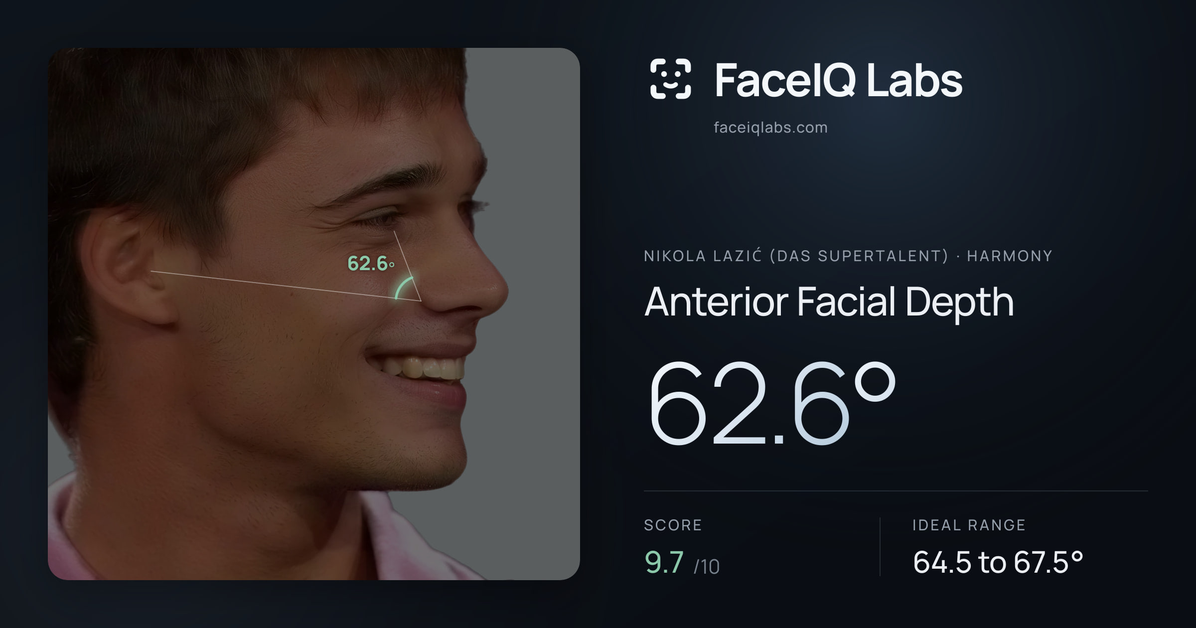Nikola Lazić (Das Supertalent) Anterior Facial Depth: 62.6°, drawn on the photo