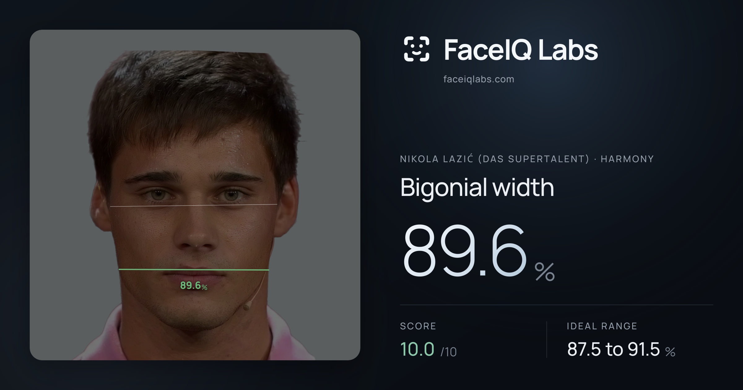 Nikola Lazić (Das Supertalent) Bigonial width: 89.6%, drawn on the photo