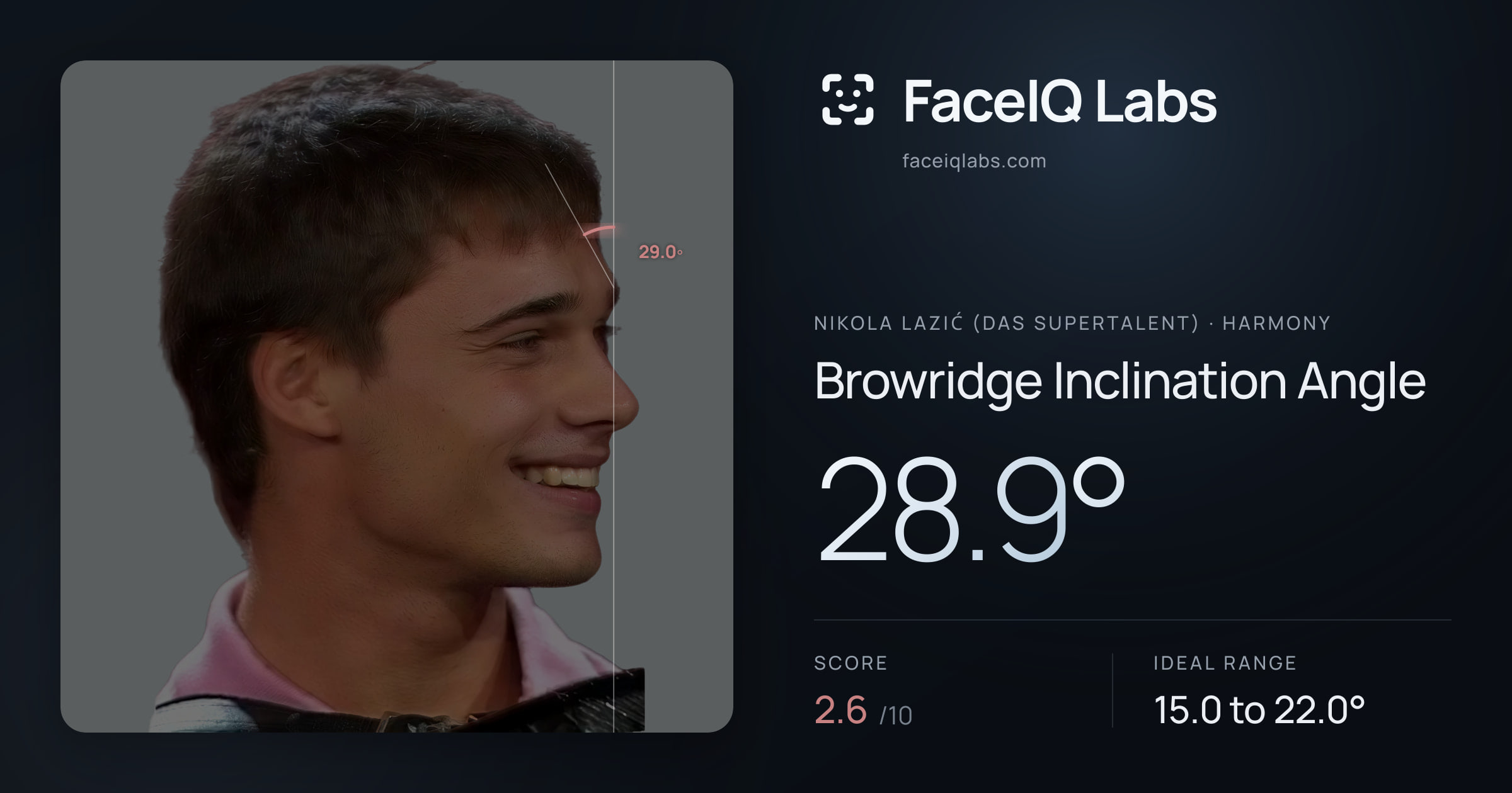 Nikola Lazić (Das Supertalent) Browridge Inclination Angle: 28.9°, drawn on the photo