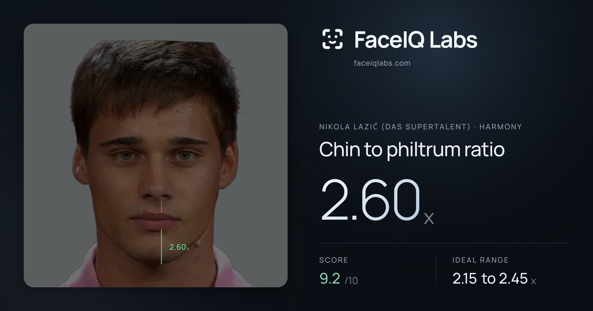 Nikola Lazić (Das Supertalent) Chin to philtrum ratio: 2.60x, drawn on the photo