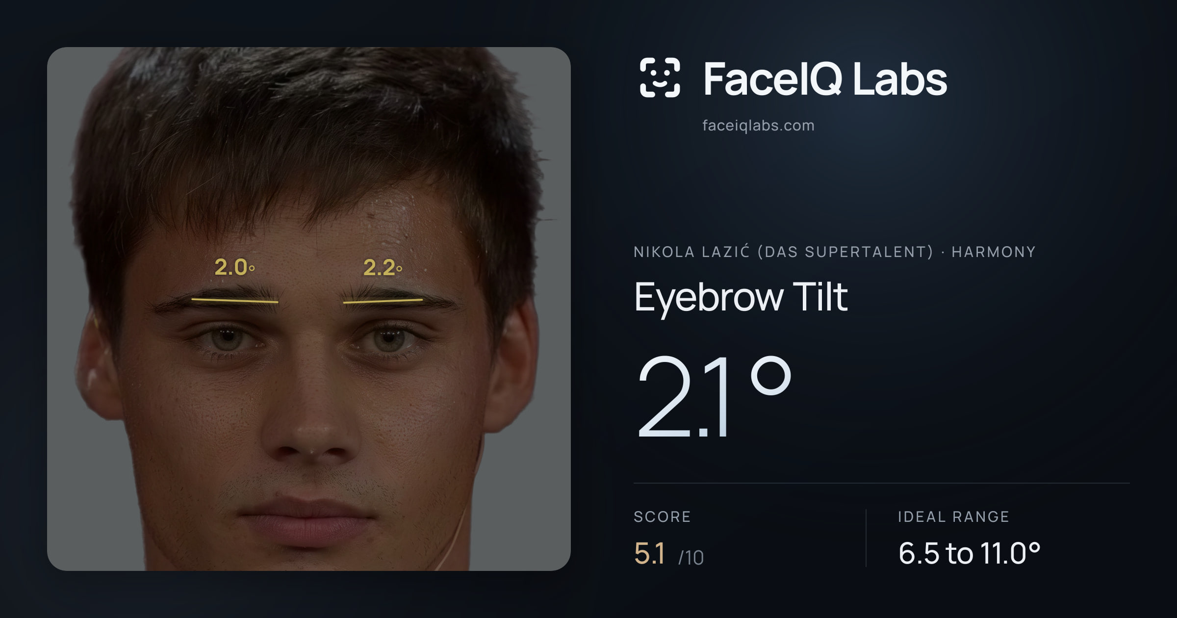 Nikola Lazić (Das Supertalent) Eyebrow Tilt: 2.1°, drawn on the photo