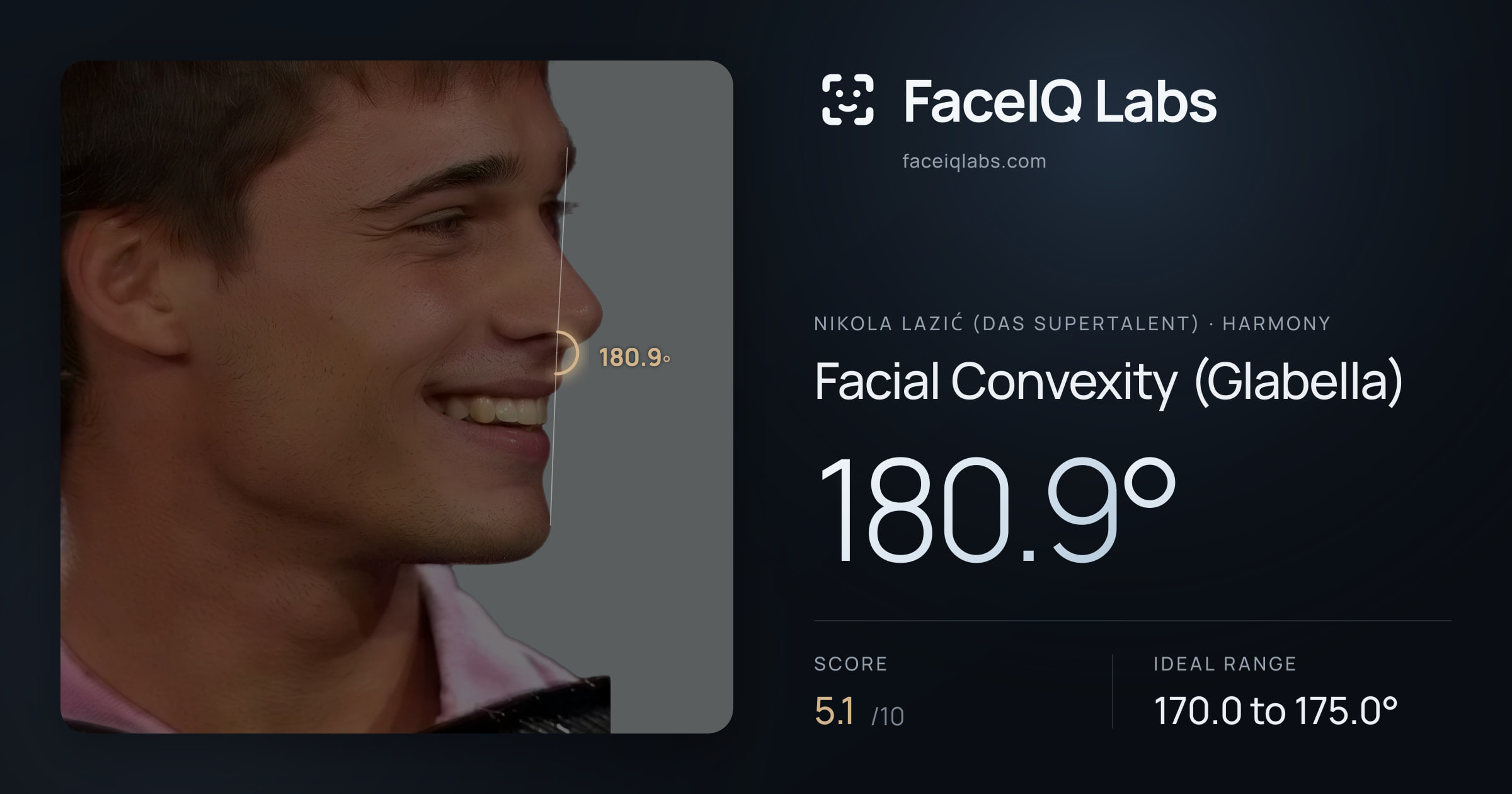 Nikola Lazić (Das Supertalent) Facial Convexity (Glabella): 180.9°, drawn on the photo
