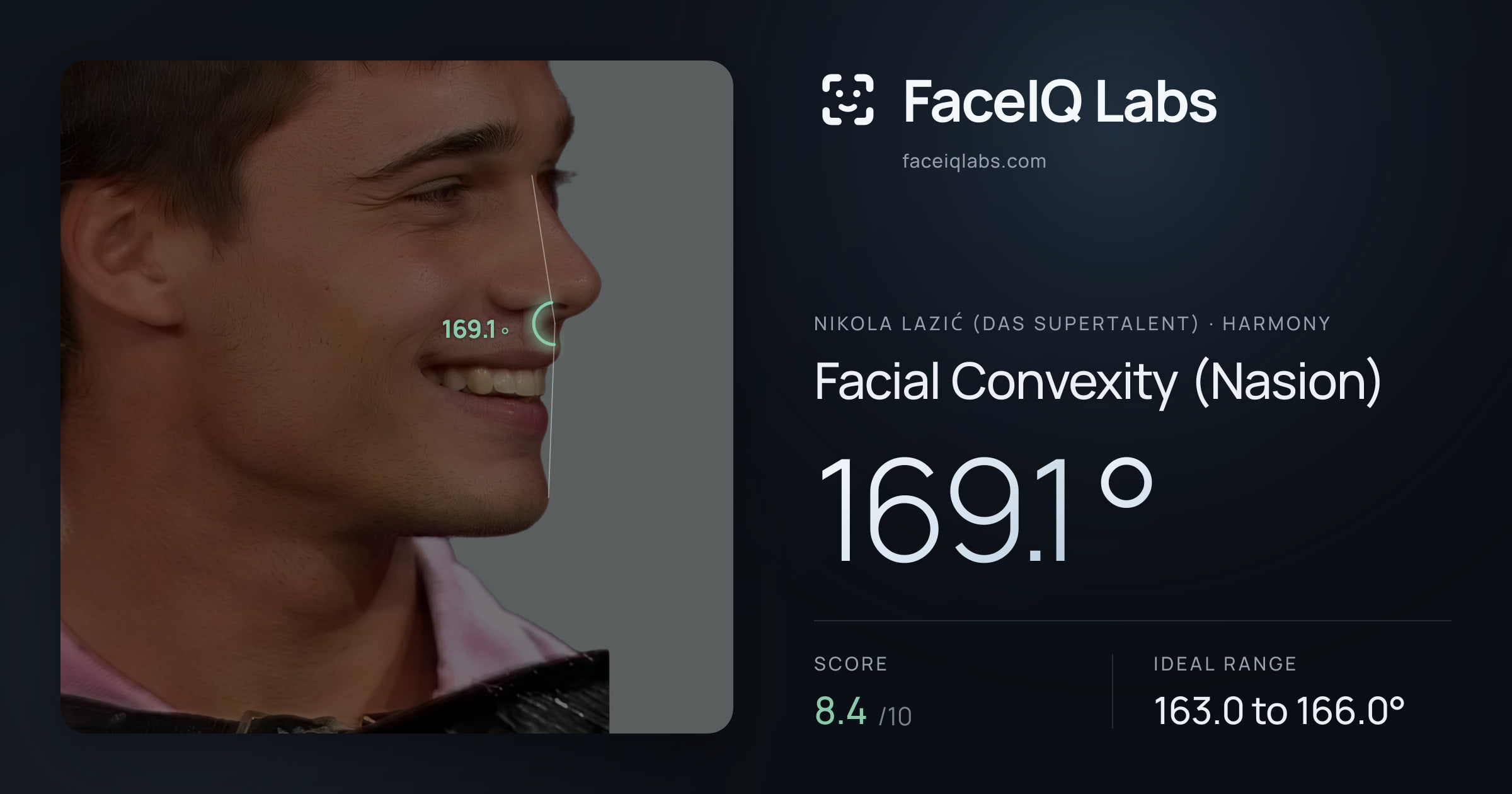 Nikola Lazić (Das Supertalent) Facial Convexity (Nasion): 169.1°, drawn on the photo