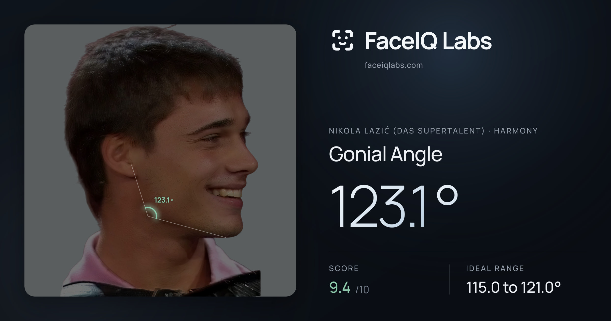 Nikola Lazić (Das Supertalent) Gonial Angle: 123.1°, drawn on the photo