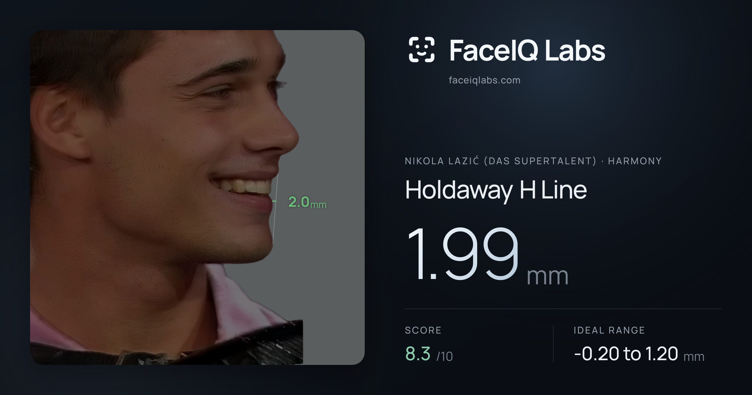 Nikola Lazić (Das Supertalent) Holdaway H Line: 1.99mm, drawn on the photo