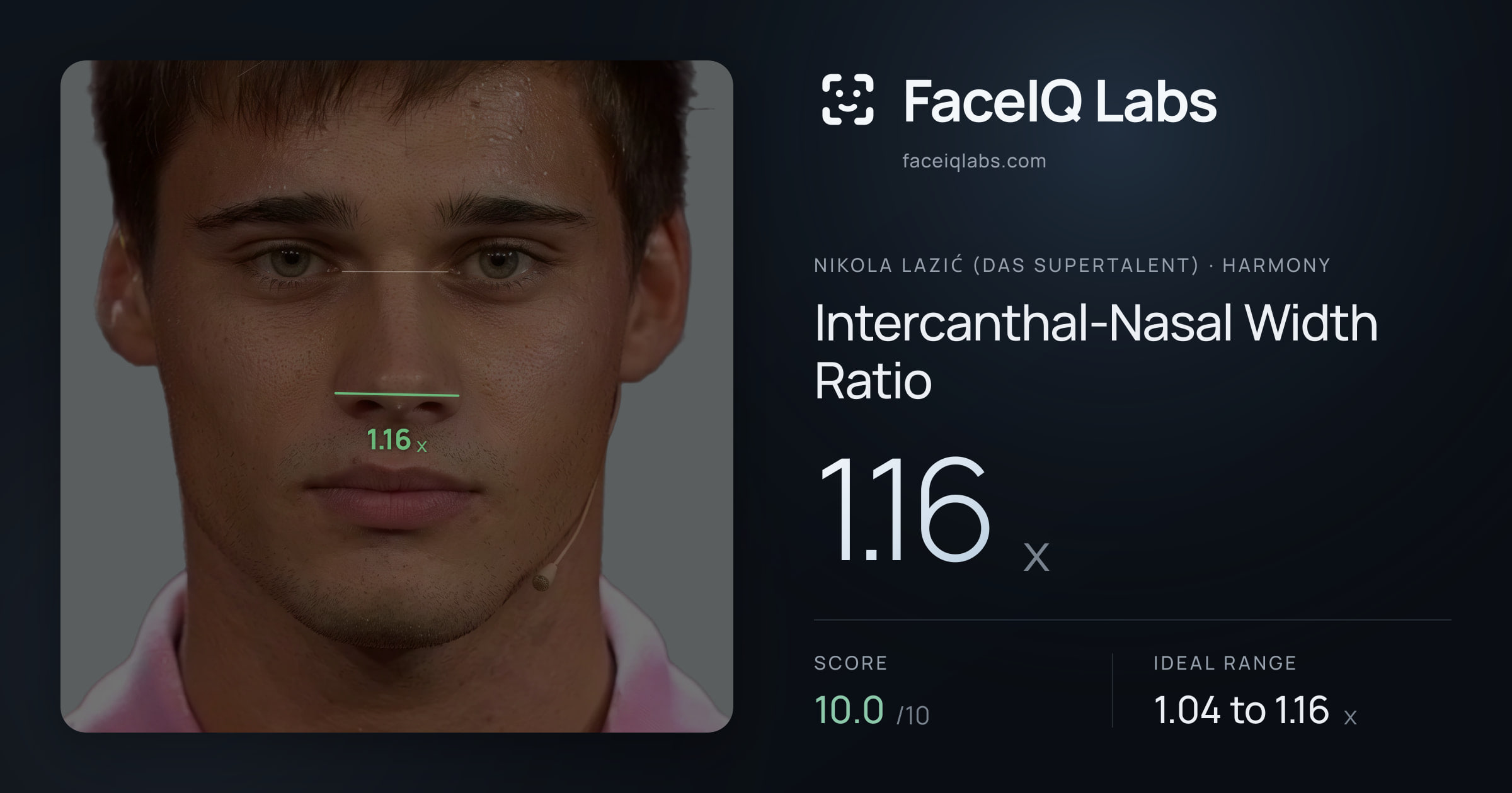 Nikola Lazić (Das Supertalent) Intercanthal-Nasal Width Ratio: 1.16x, drawn on the photo