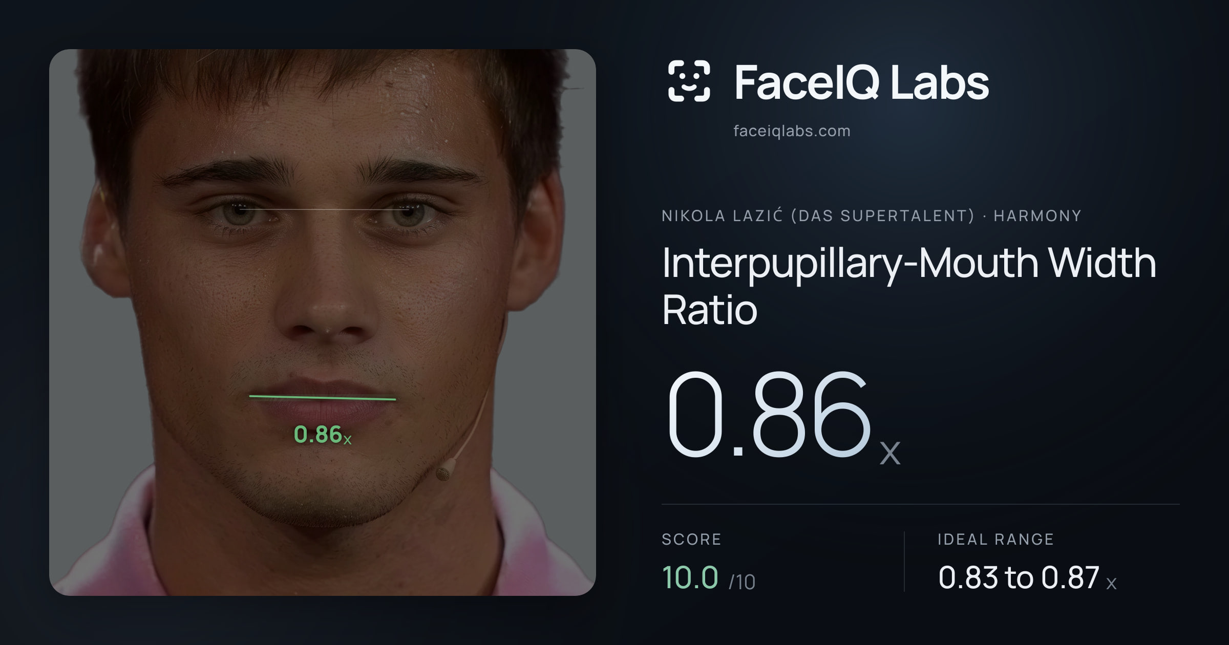 Nikola Lazić (Das Supertalent) Interpupillary-Mouth Width Ratio: 0.86x, drawn on the photo