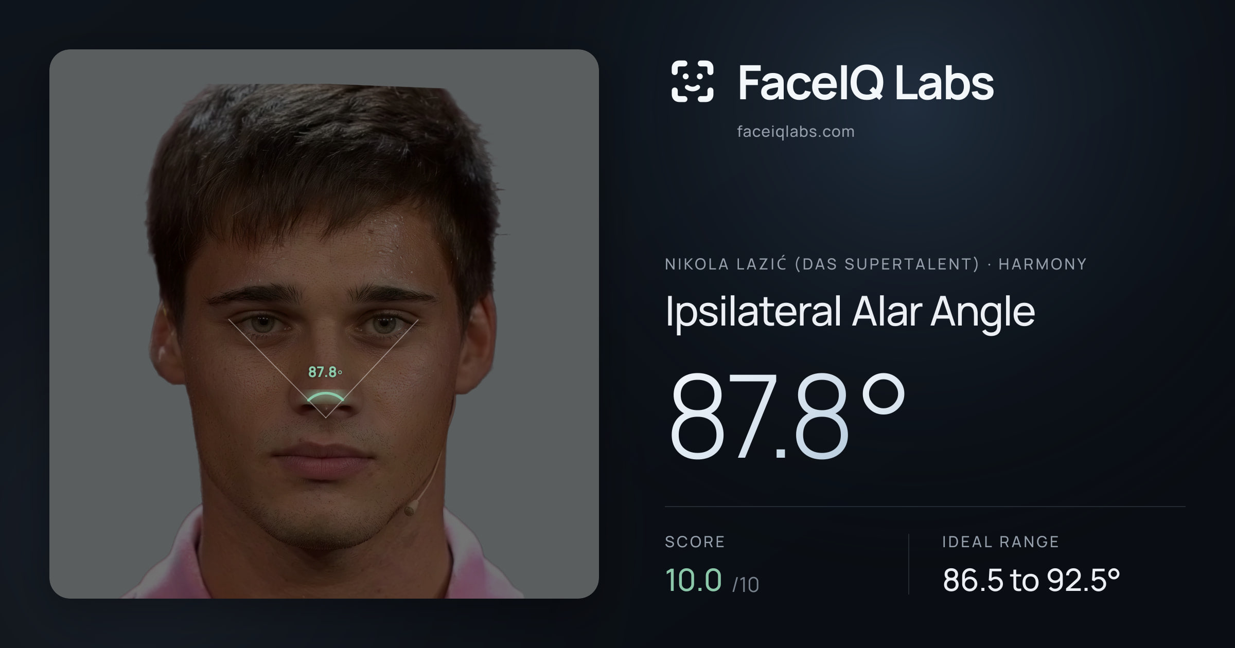 Nikola Lazić (Das Supertalent) Ipsilateral Alar Angle: 87.8°, drawn on the photo