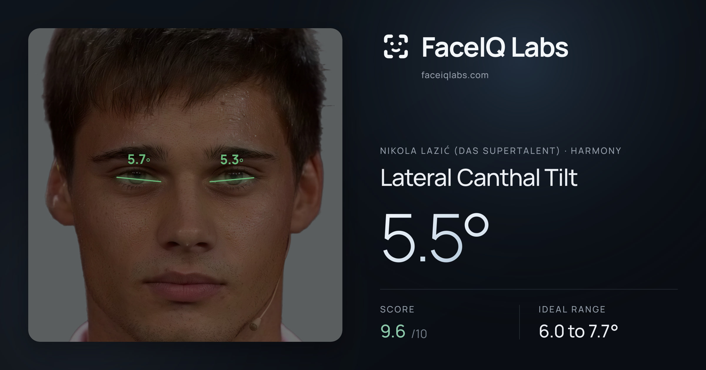 Nikola Lazić (Das Supertalent) Lateral Canthal Tilt: 5.5°, drawn on the photo